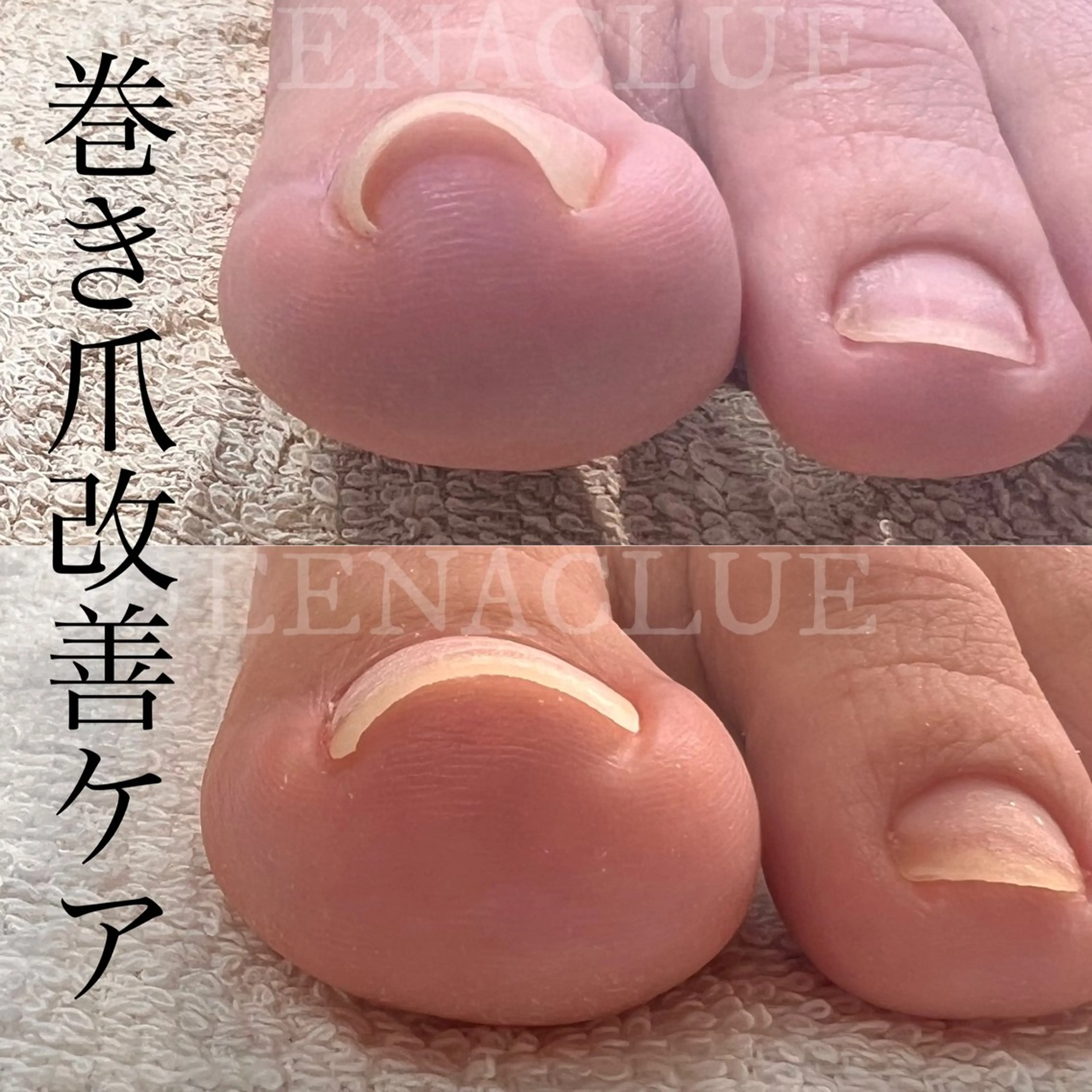 ネイル 毛穴改善/脱毛 ネイル　川上久仁子のエステ・リラクイメージ