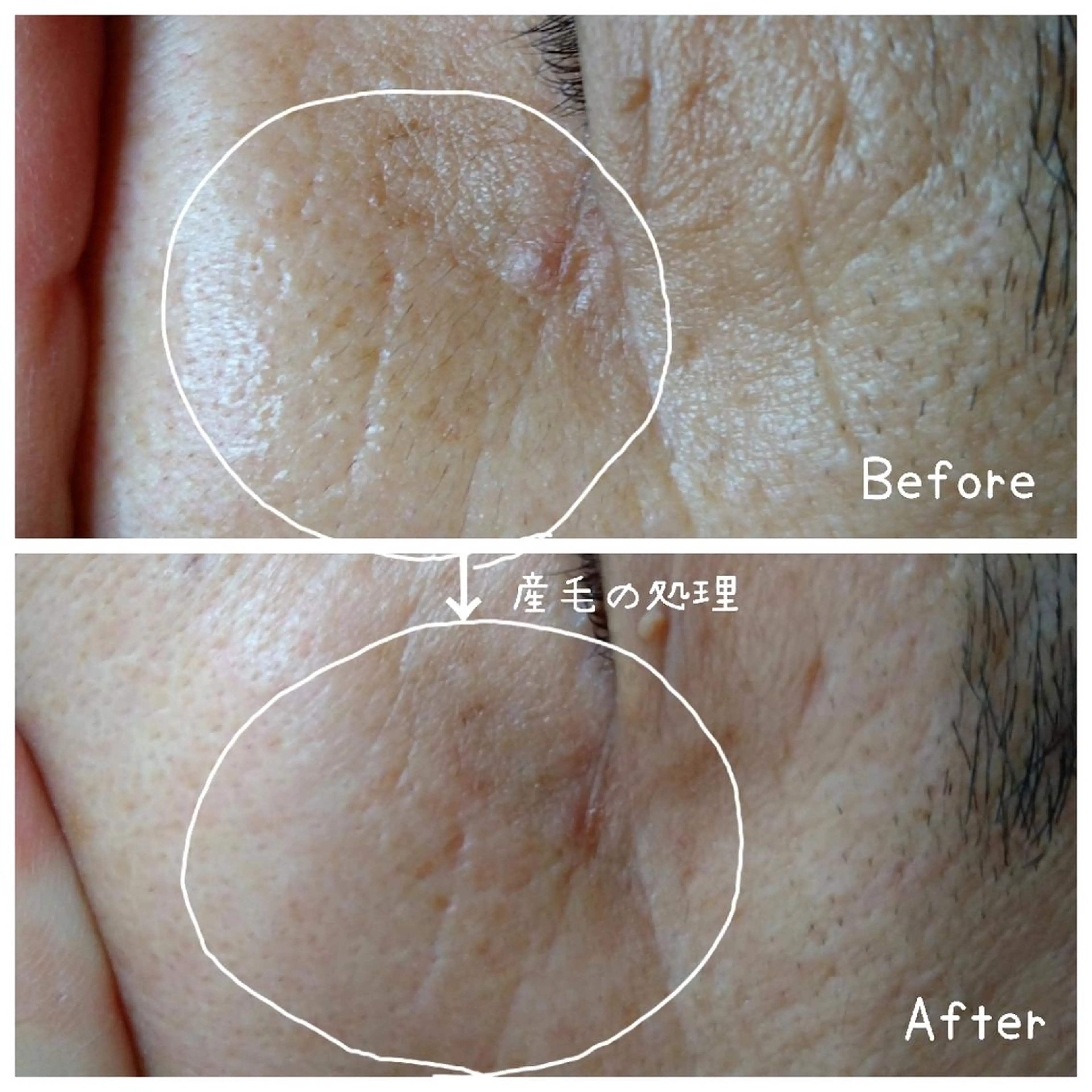 メンズ のなか みきのマツエク・マツパデザイン