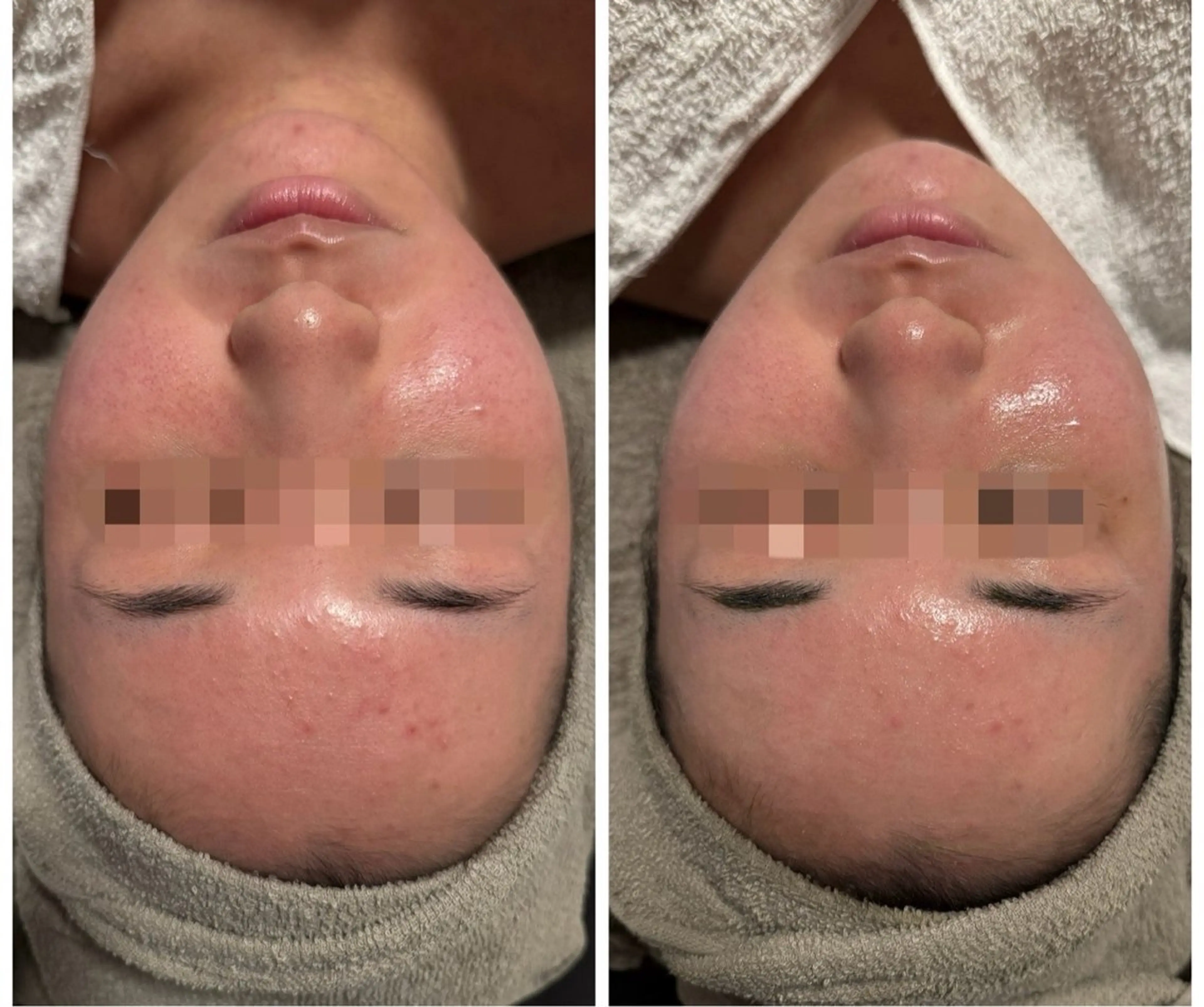 lumi riseのエステ・リラクイメージ