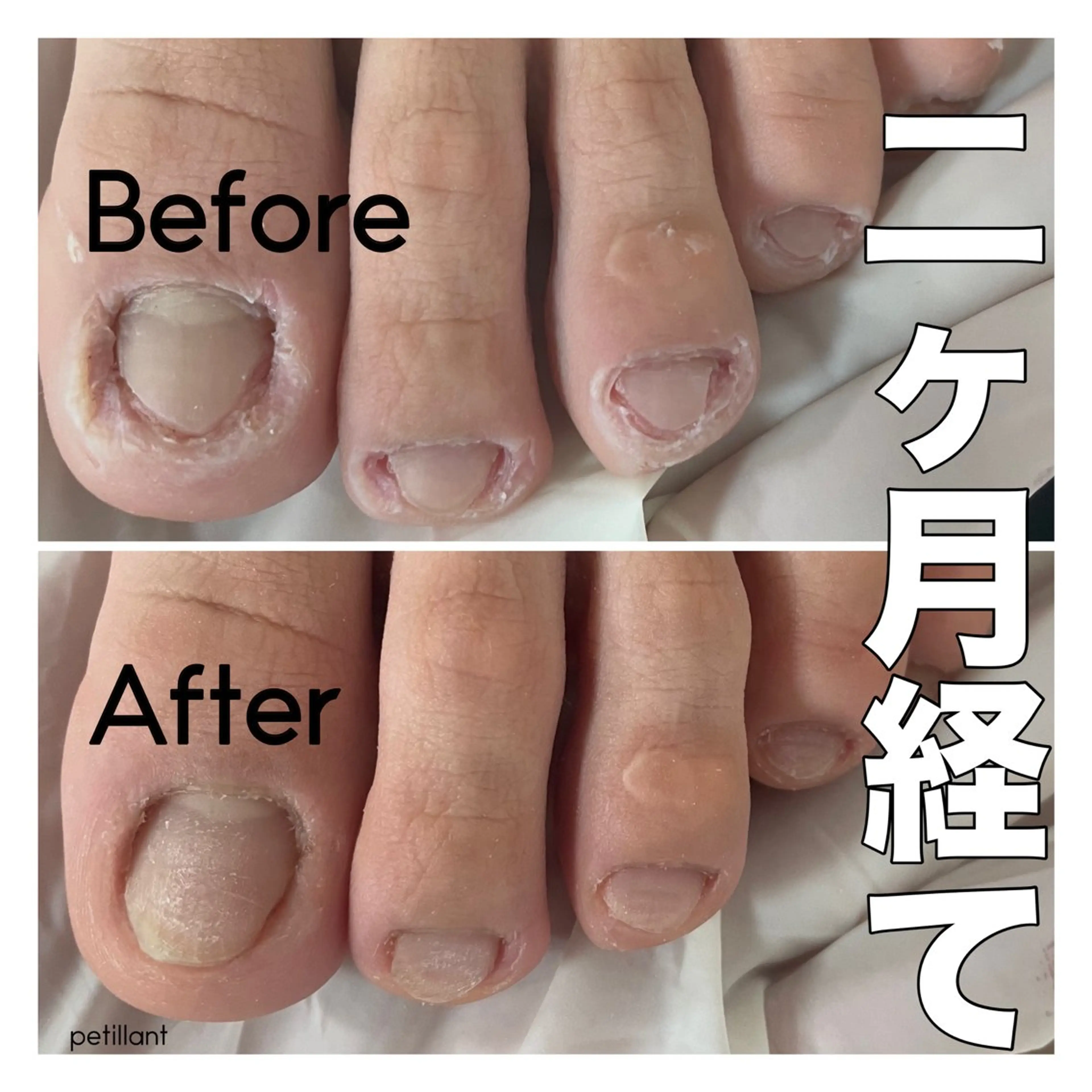 ネイル nail salon petillantのネイルデザイン
