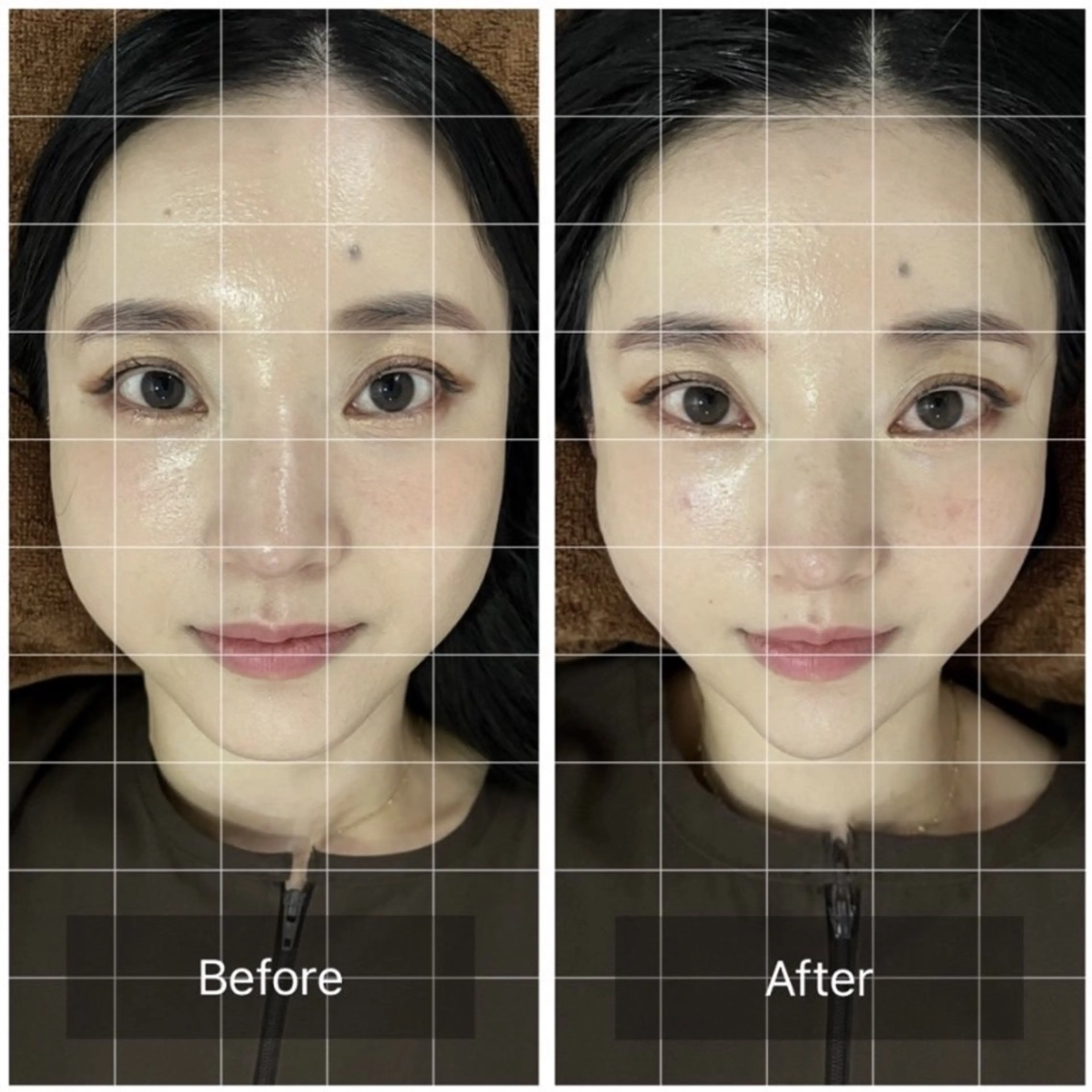 メンズ エステ リラク Spring鍼灸院 ✨首肩こり、腰痛に！のその他イメージ