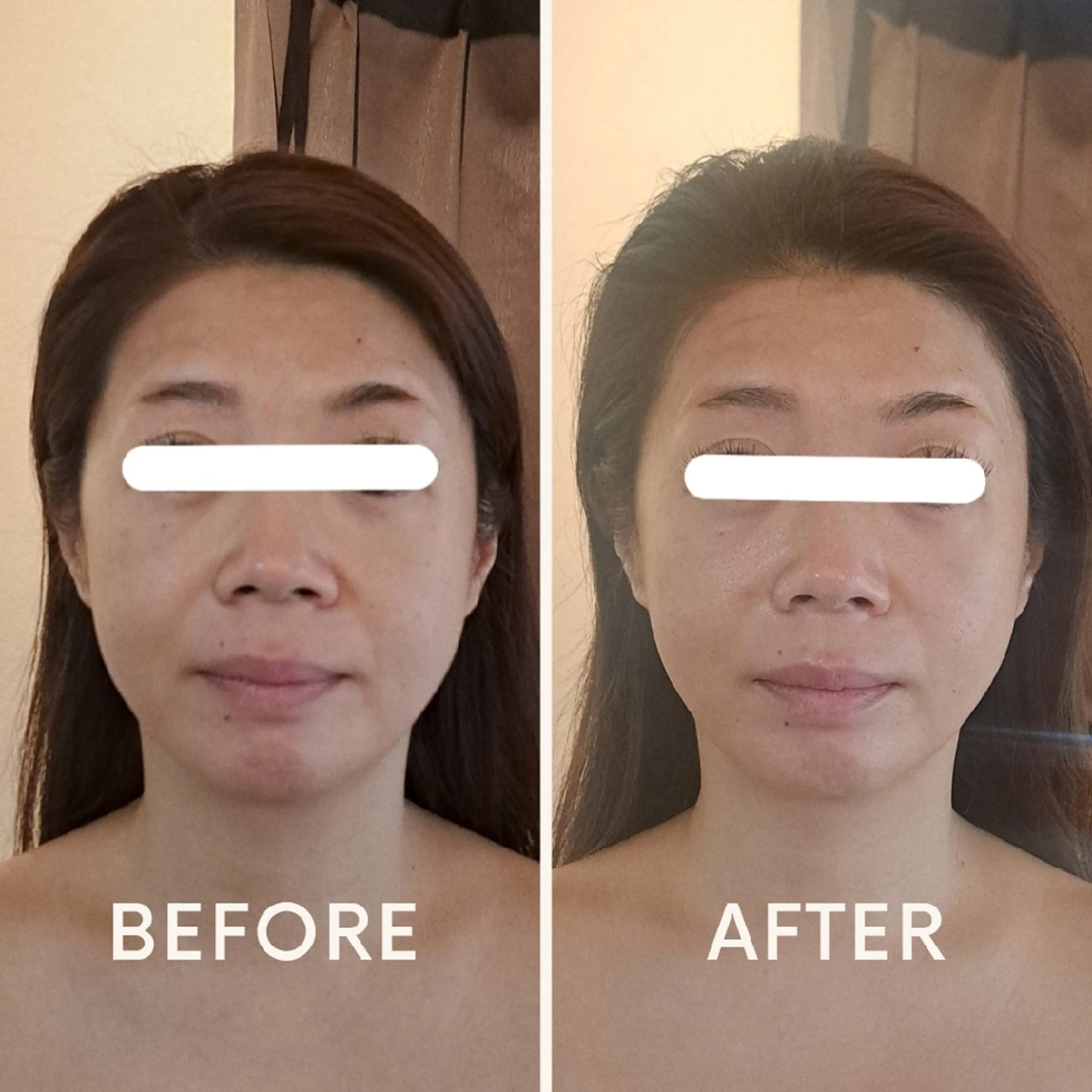 エステ リラク 美容鍼×エステ　鍼灸 サロンmiyabiのエステ・リラクイメージ