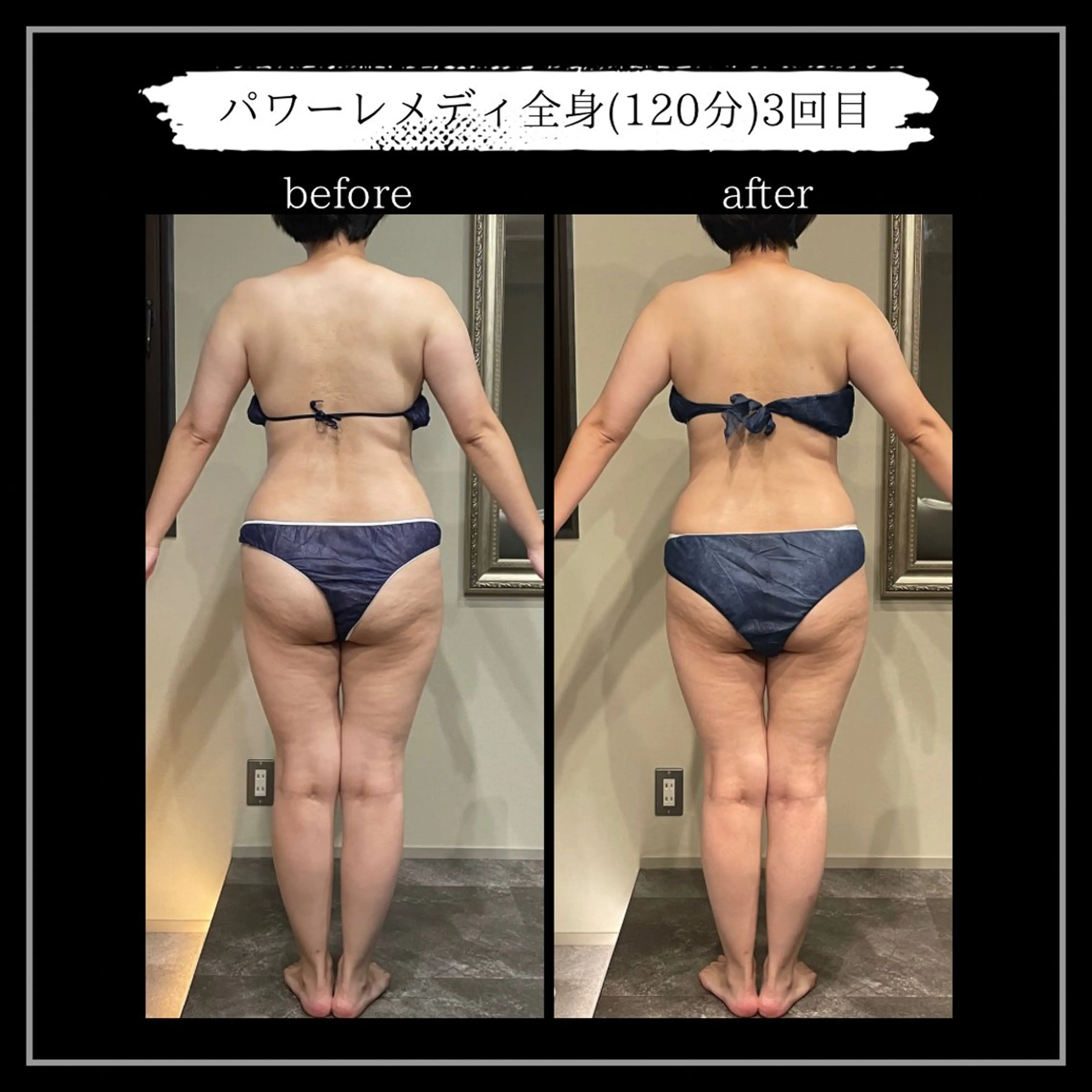 オフ:オン 全身筋膜マッサージのエステ・リラクイメージ