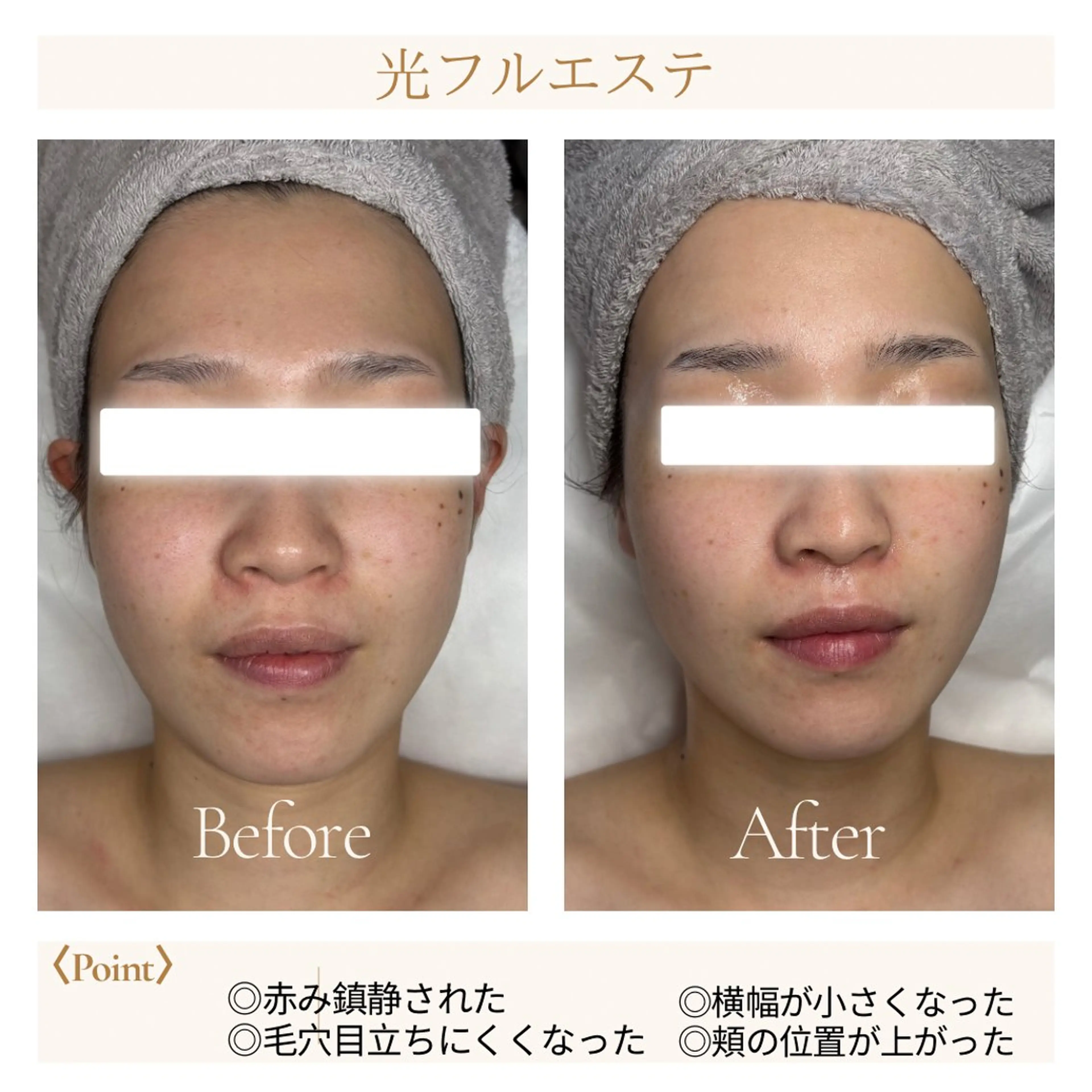 エステ Grande所属・11/1〜Open！ 旭川ナリス脱毛エステのエステ・リラクイメージ