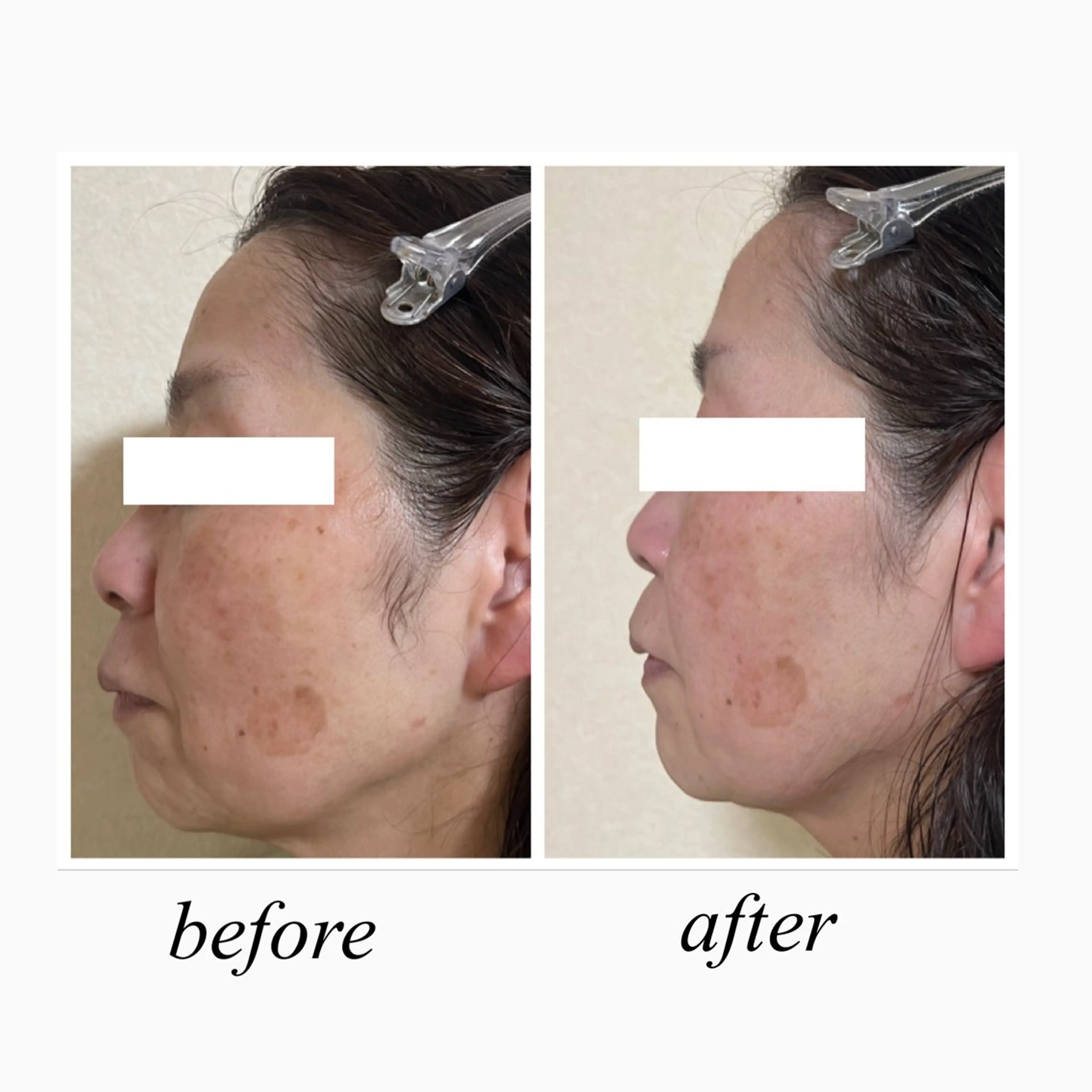 Aspility /天文館のエステ・リラクイメージ