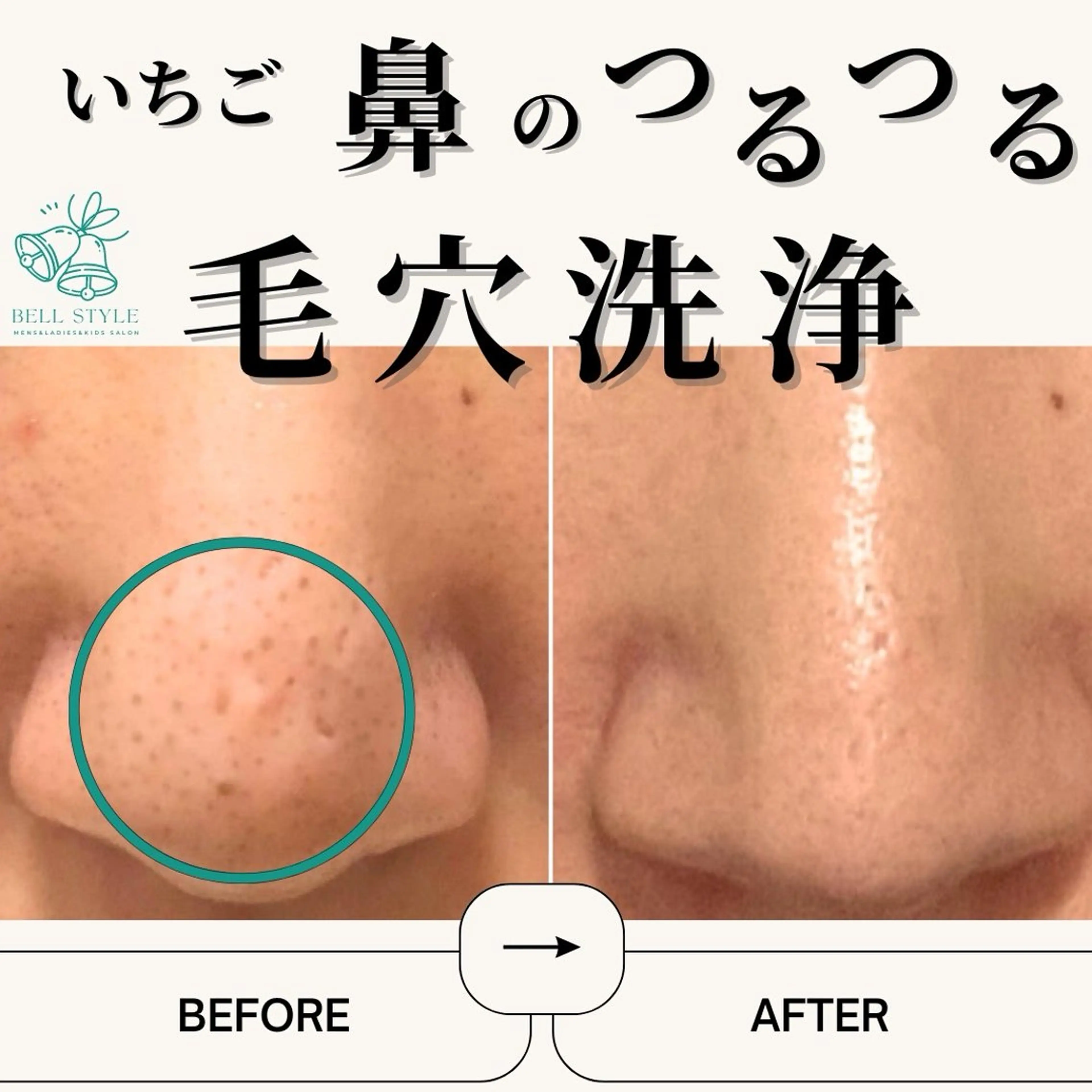 メンズ 【脱毛・美肌専門】メンズ&レディースサロンBell style所属・【脱毛・美肌専門】 bellstyleのエステ・リラクイメージ