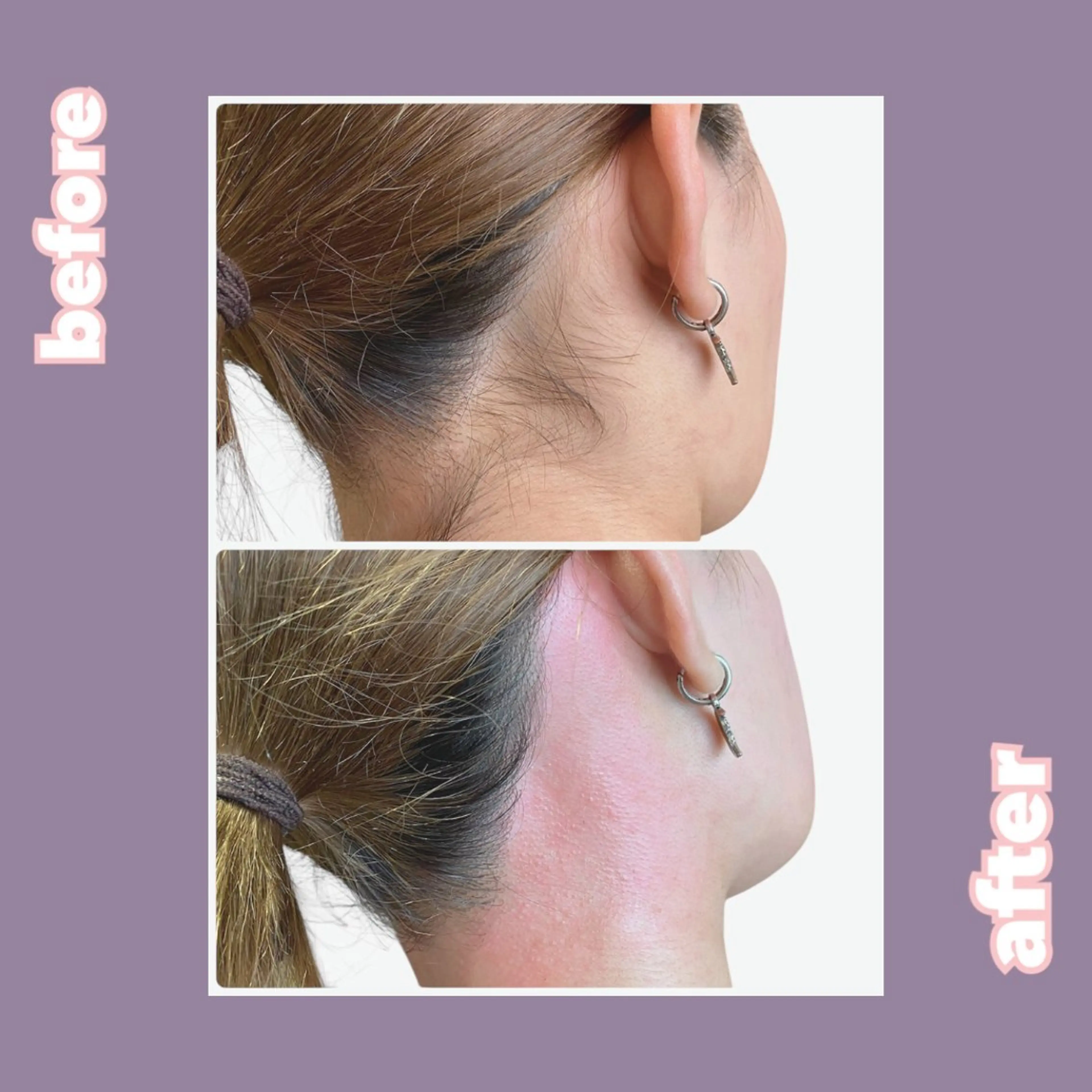 冷えむくみ改善専門 REBISKIN🌿のエステ・リラクイメージ