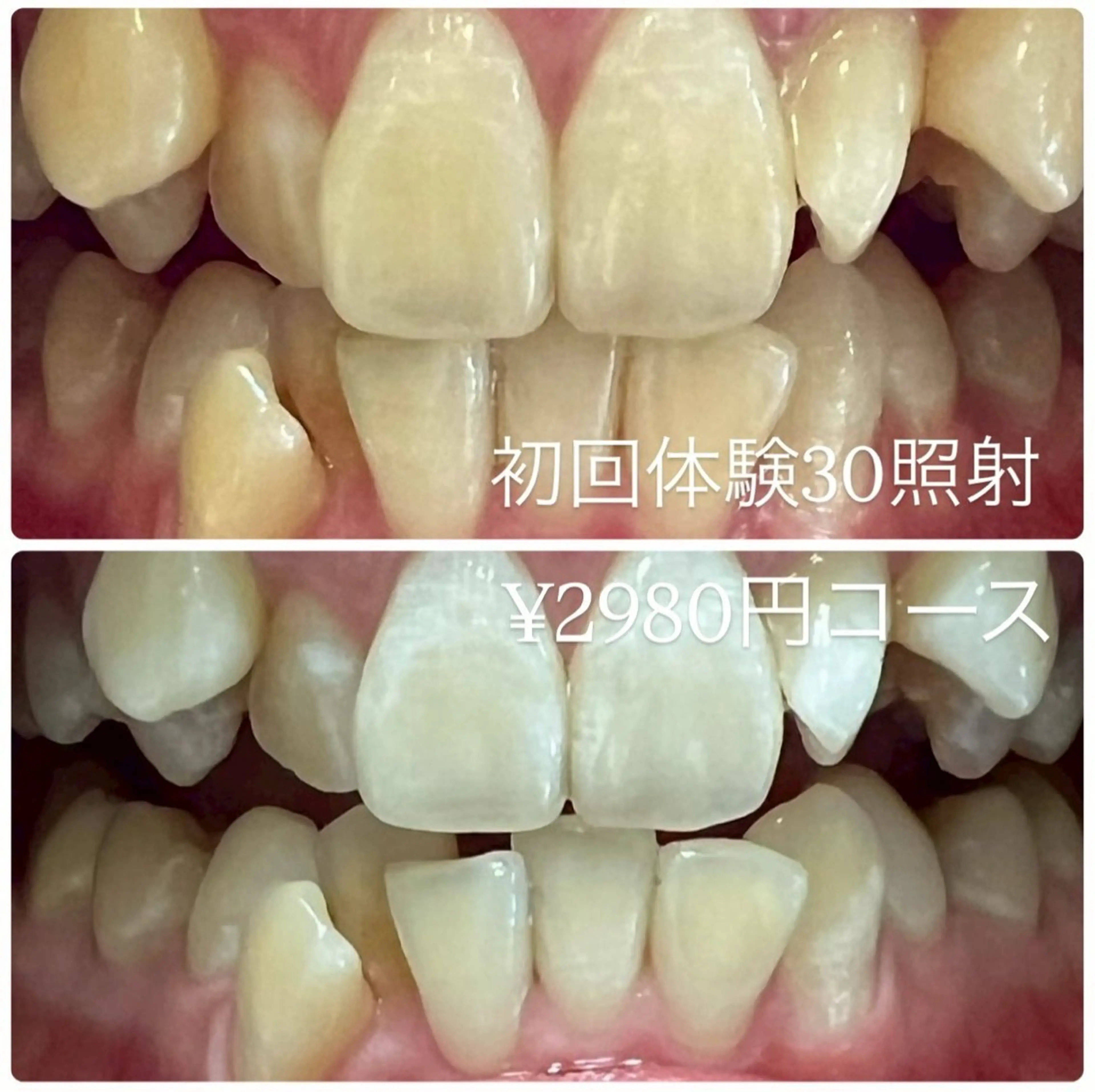 ホワイトニングルーム 横浜店のその他イメージ