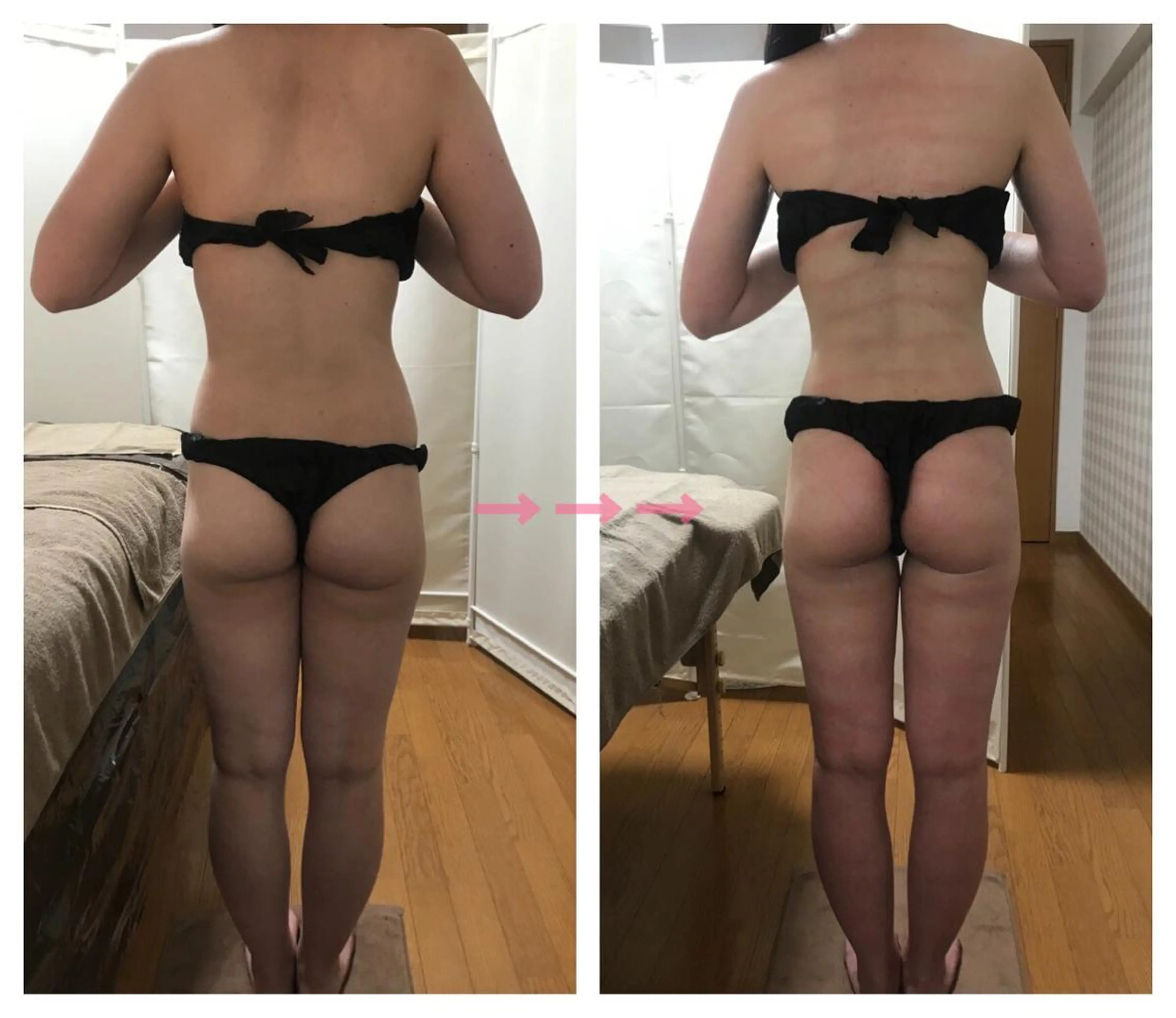 《本気痩せ×疲労改善 》  BILOOPのエステ・リラクイメージ