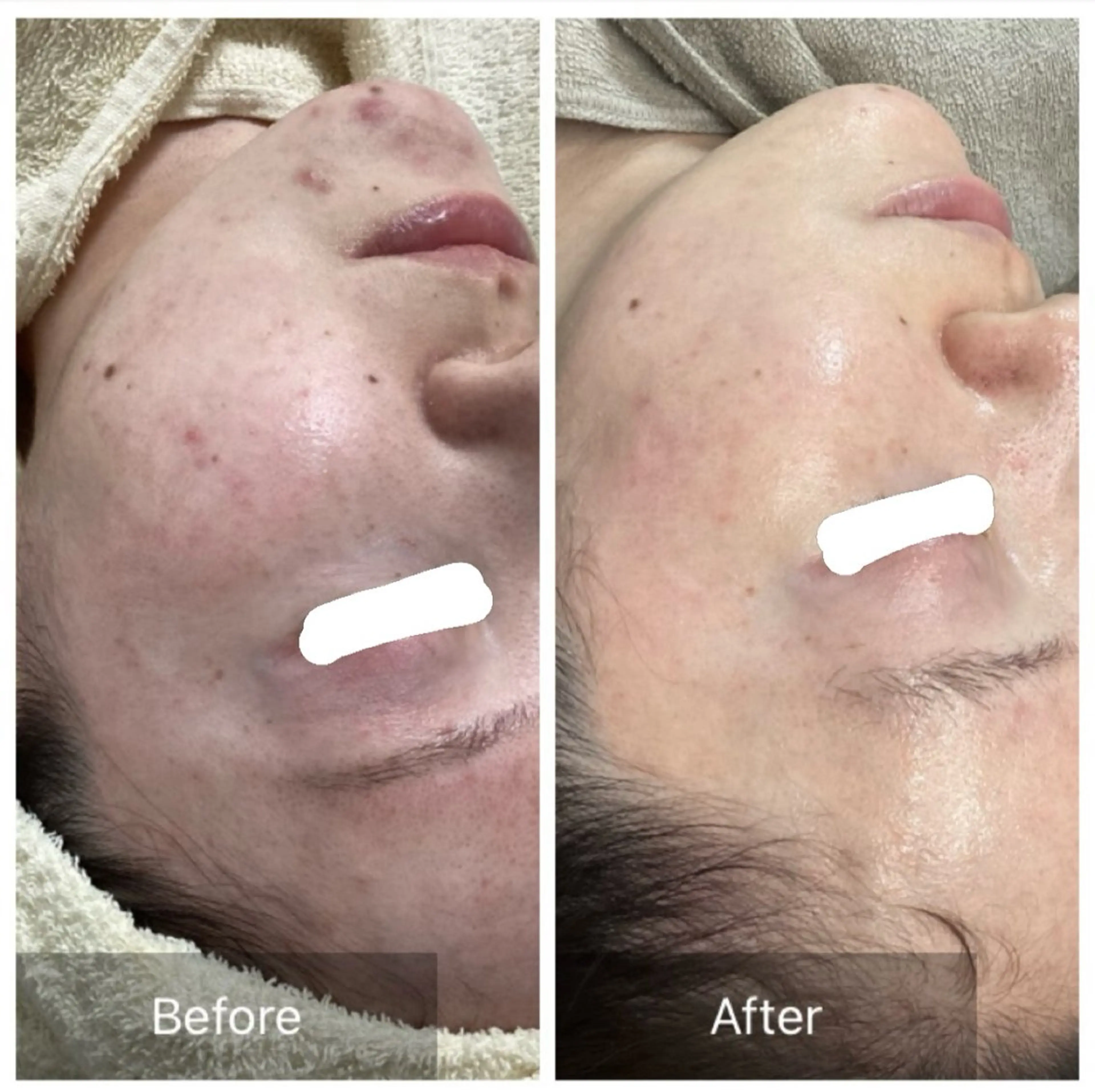 エステ Dahlia Moriのエステ・リラクイメージ