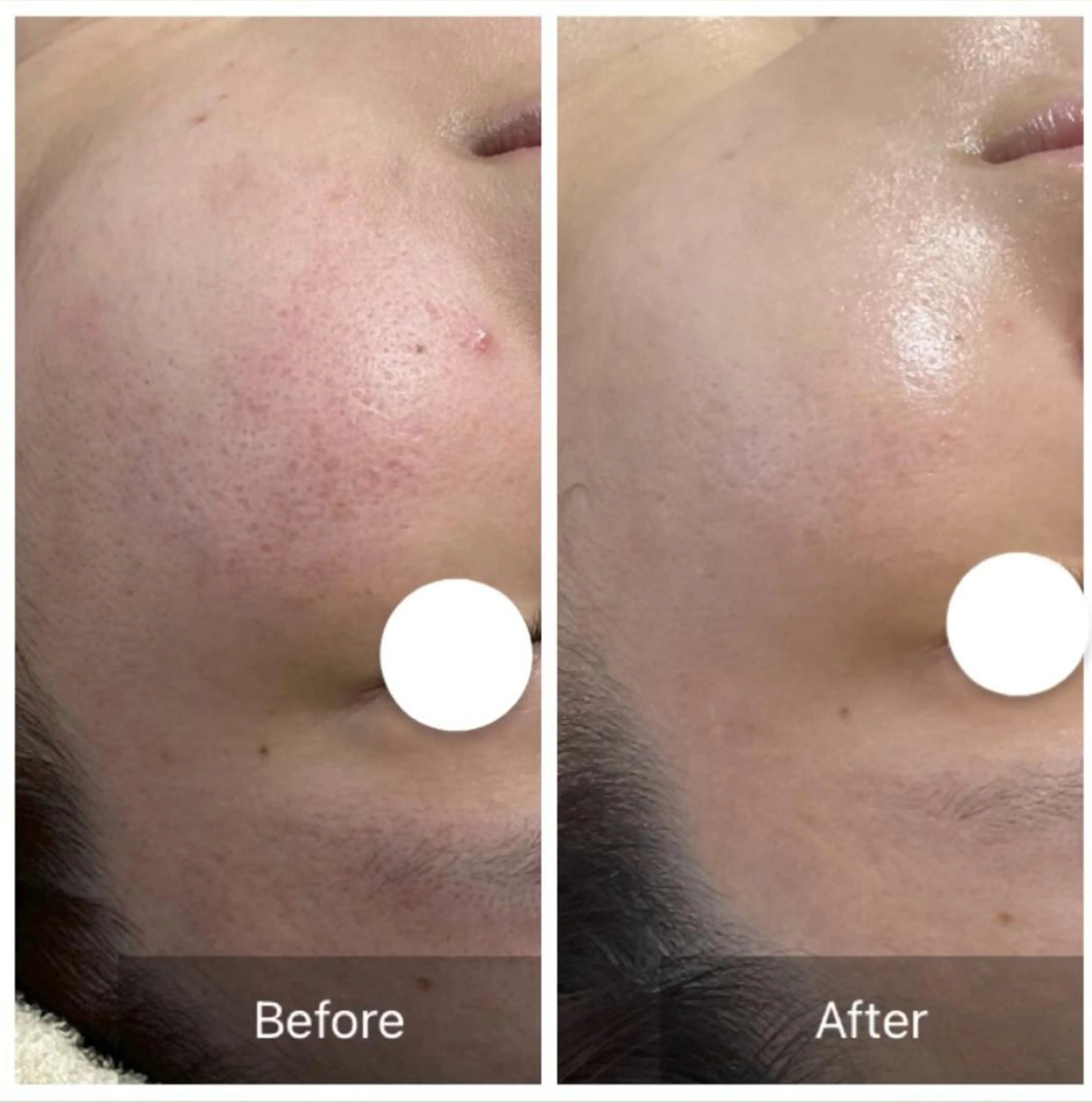 エステ Dahlia Moriのエステ・リラクイメージ