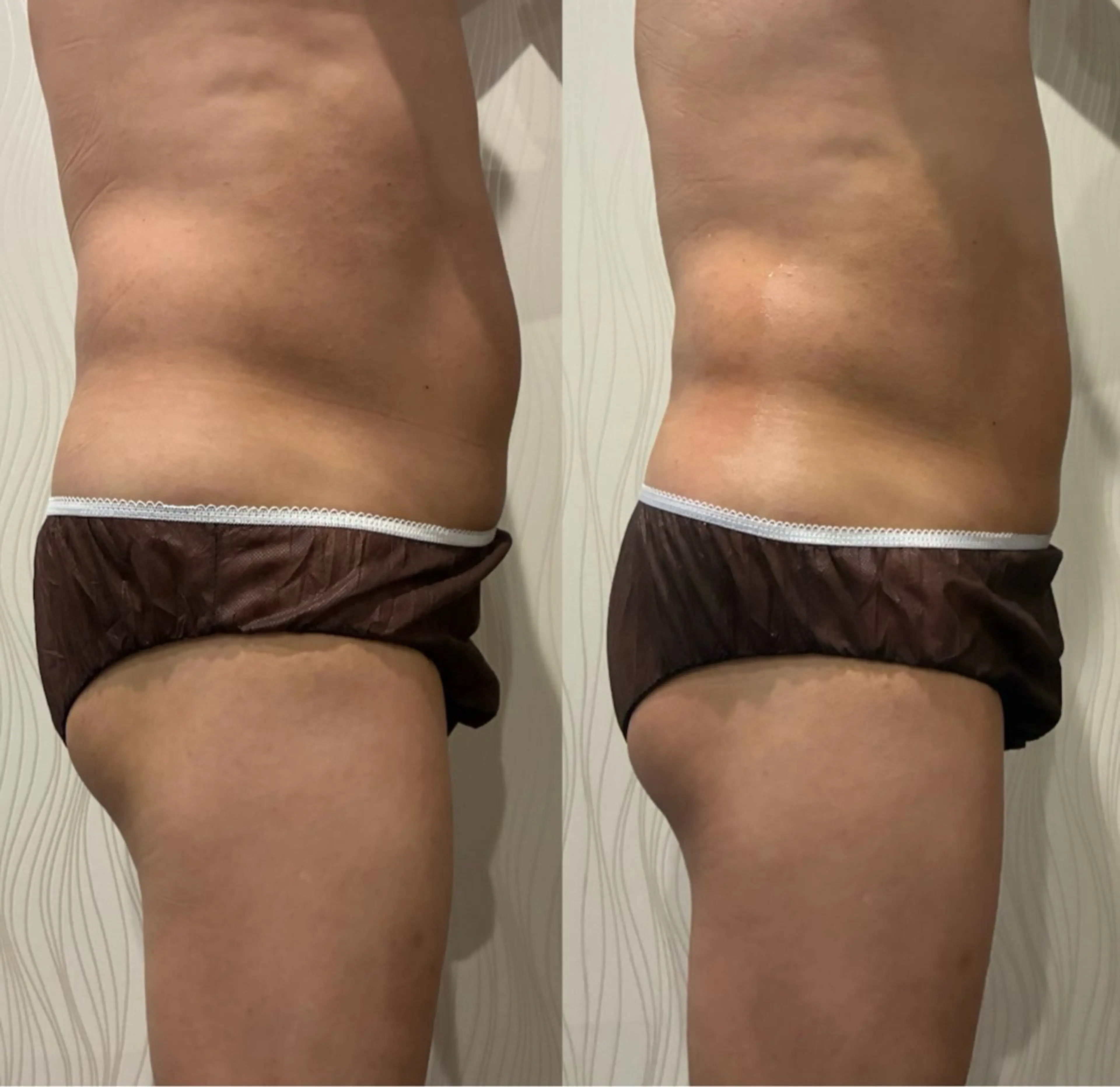 エステ Dahlia痩身脱毛 フェイシャル 中村のエステ・リラクイメージ