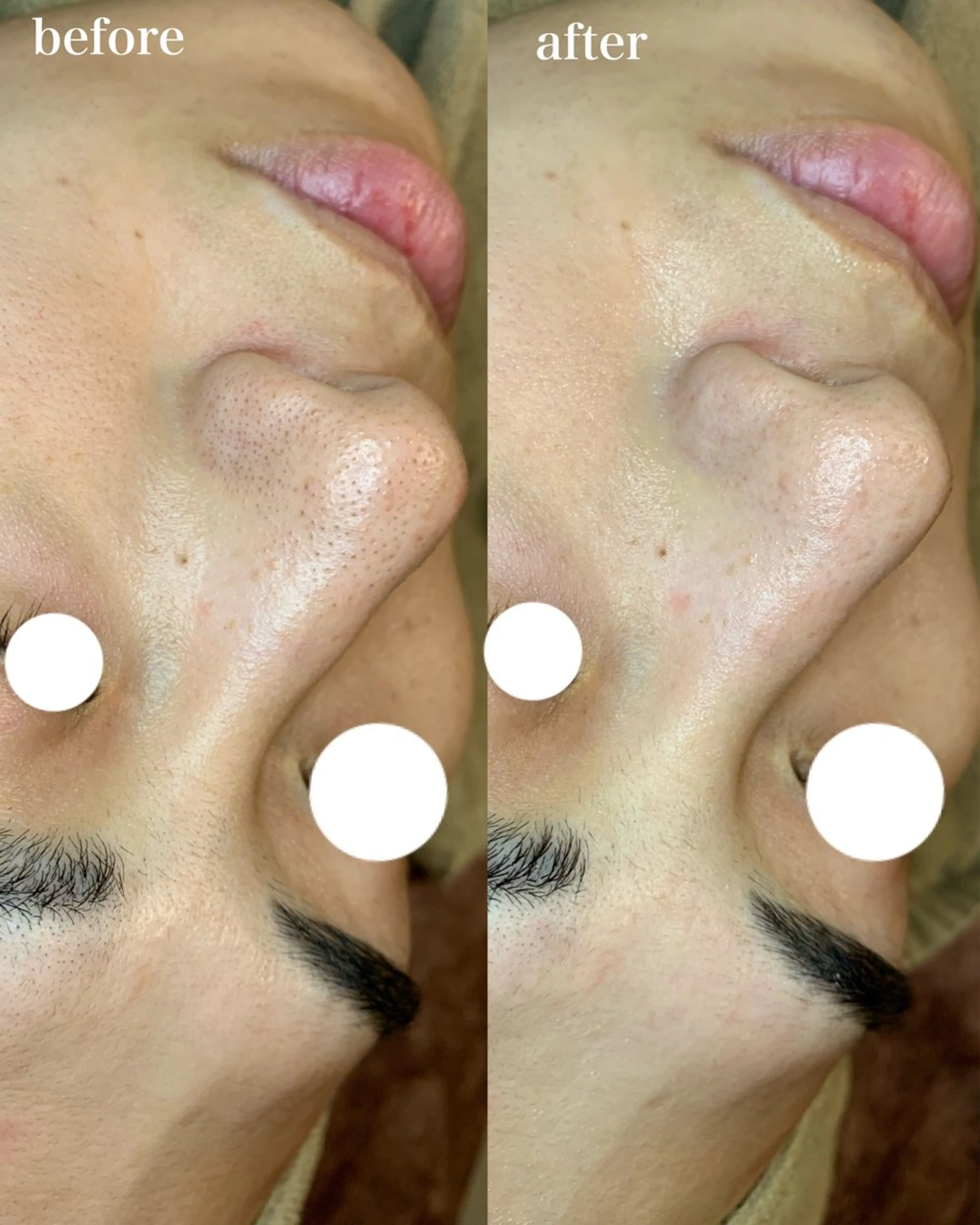 【都度払い専門店】 エステサロARTI,のエステ・リラクイメージ