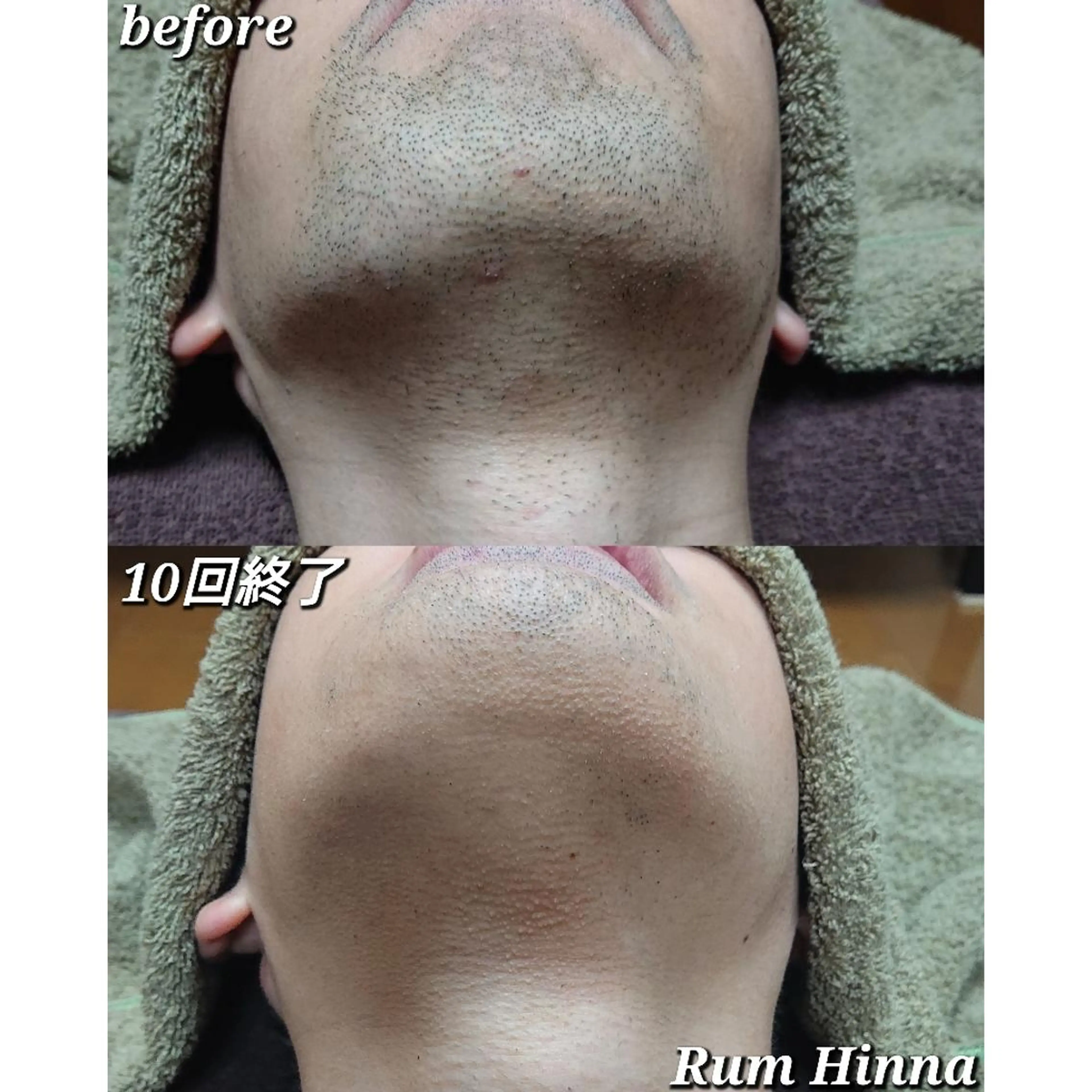 Rum Hinna ラムヒンナーのその他イメージ