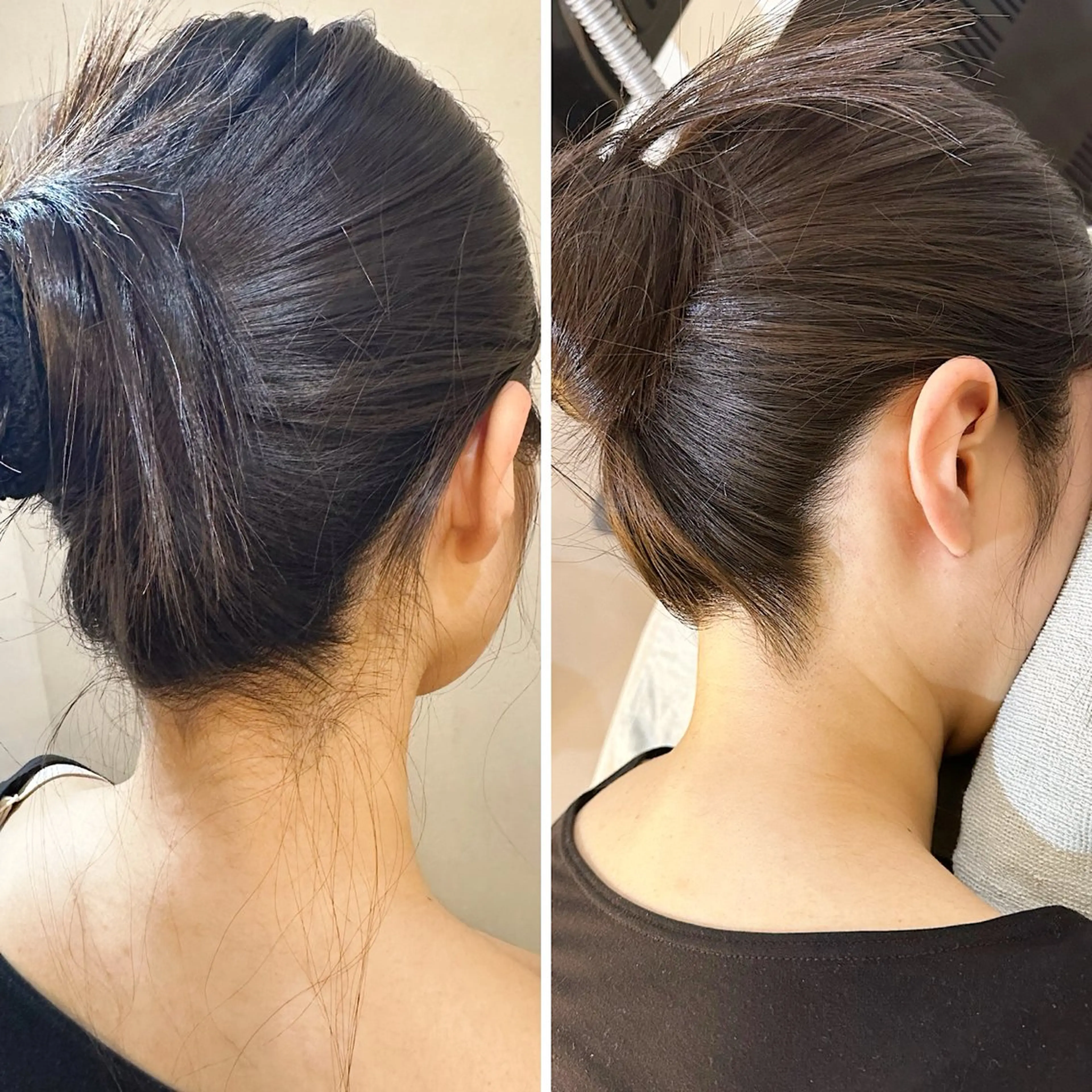 脱毛 うなじ脱毛/美肌脱毛 LABELのエステ・リラクイメージ