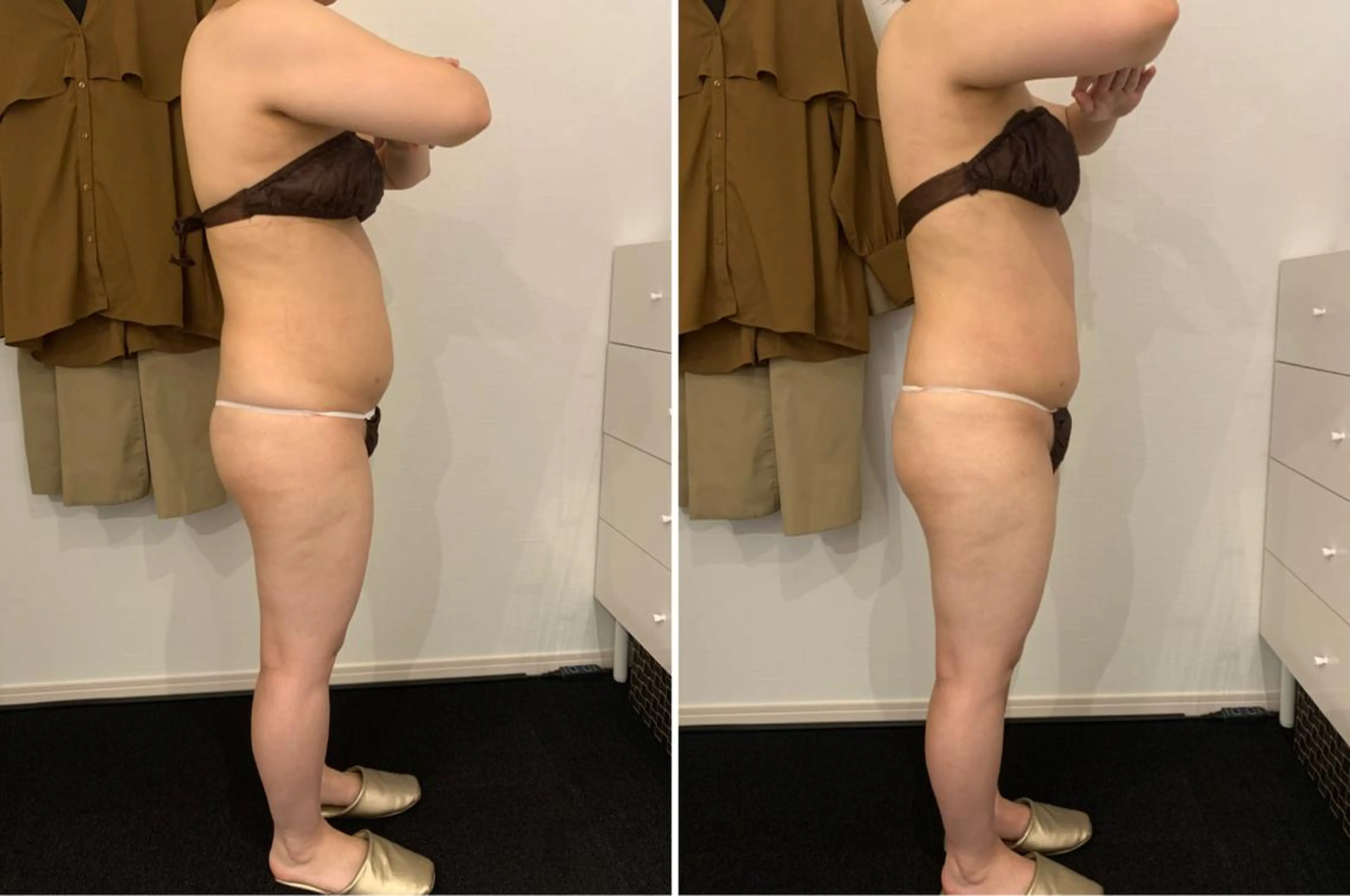 VILUZT スタッフのエステ・リラクイメージ