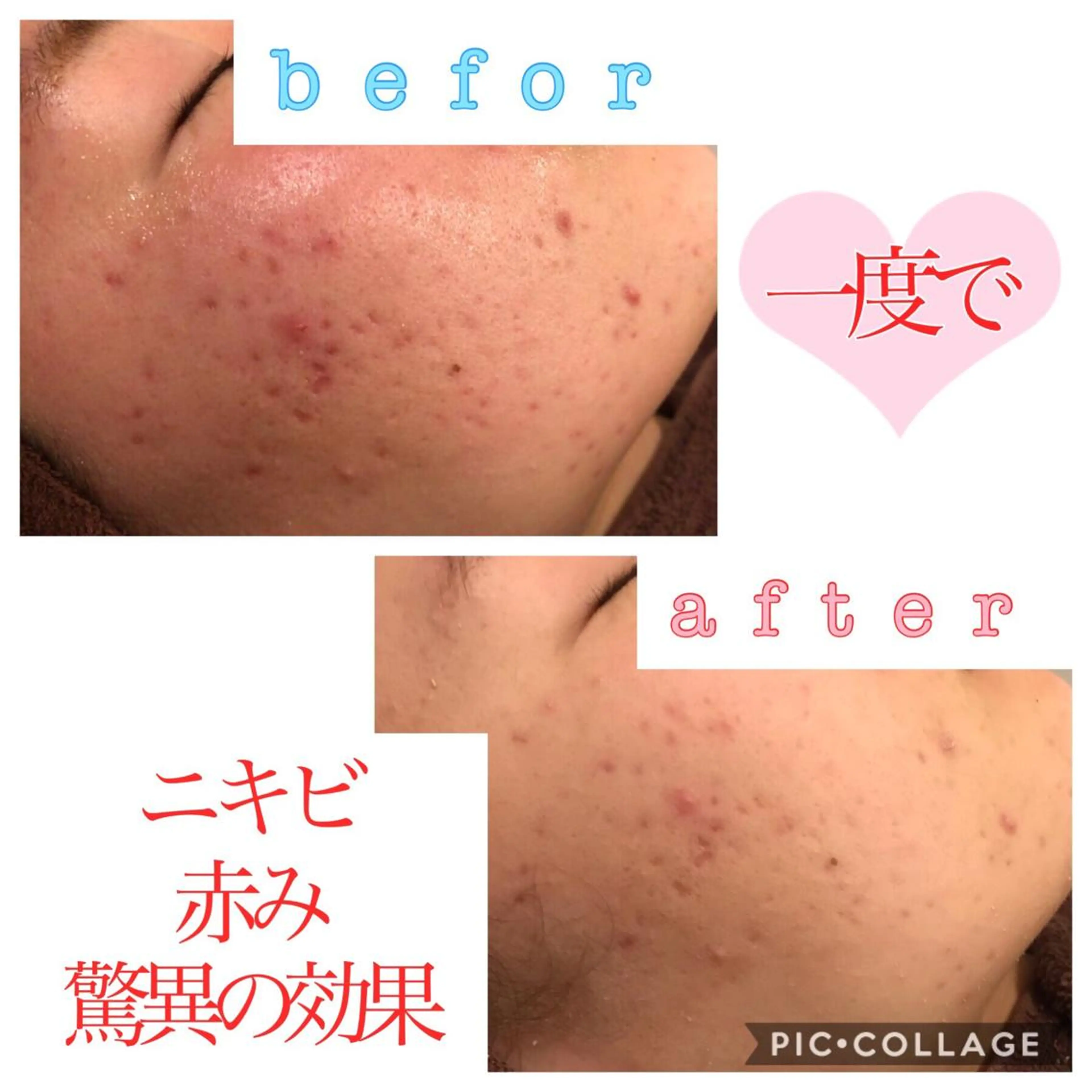 セミロング カラー パーマ ヘアアレンジ メンズ キッズ ネイル マツエク・マツパ 金の糸脱毛 産毛ケア専門のエステ・リラクイメージ