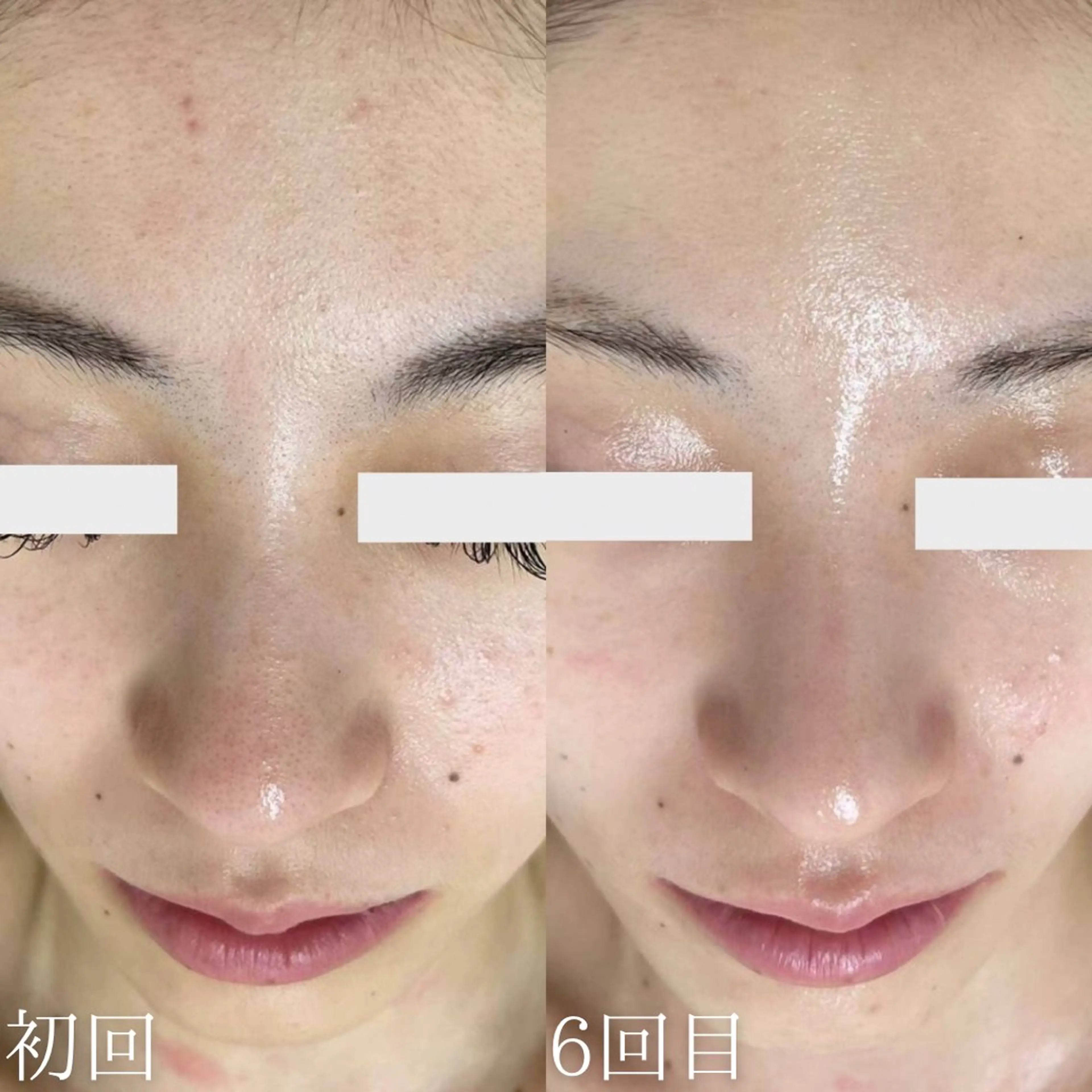 エステ 韓国美肌/肌質改善 【天神】のエステ・リラクイメージ