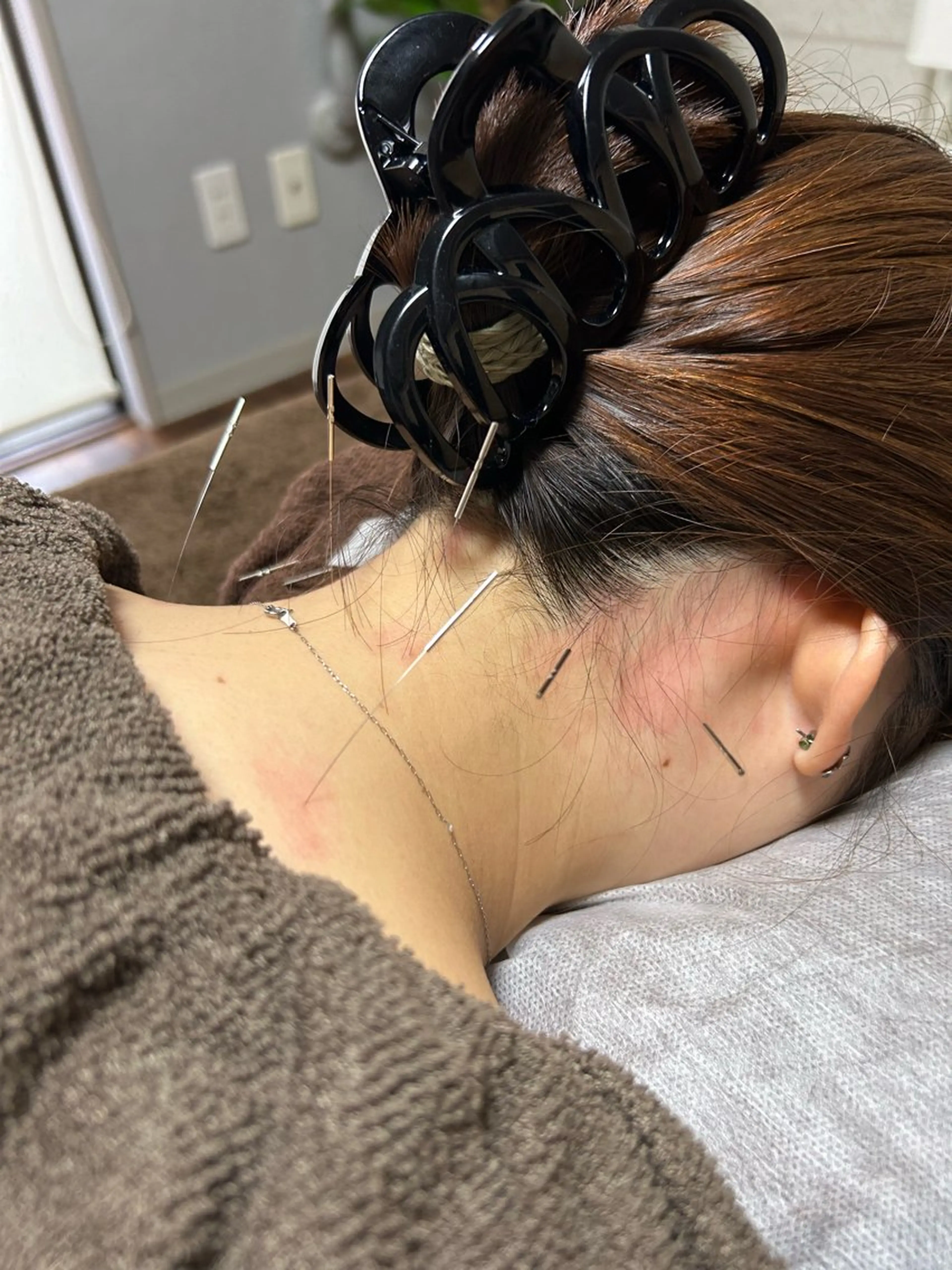 clear所属・clear鍼灸院 清水【吉祥寺】のエステ・リラクイメージ