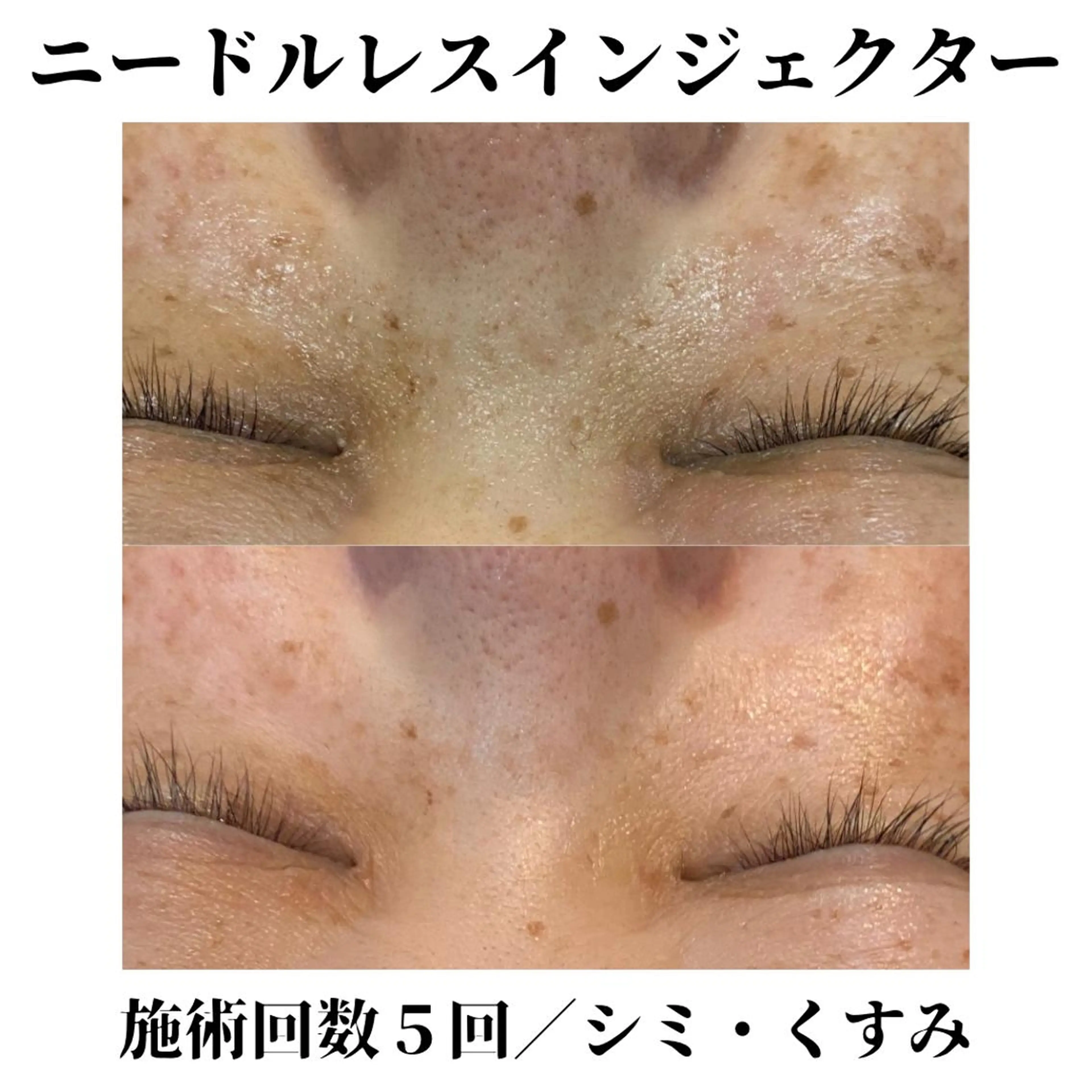 トータルビューティー サロンSalaのマツエク・マツパデザイン