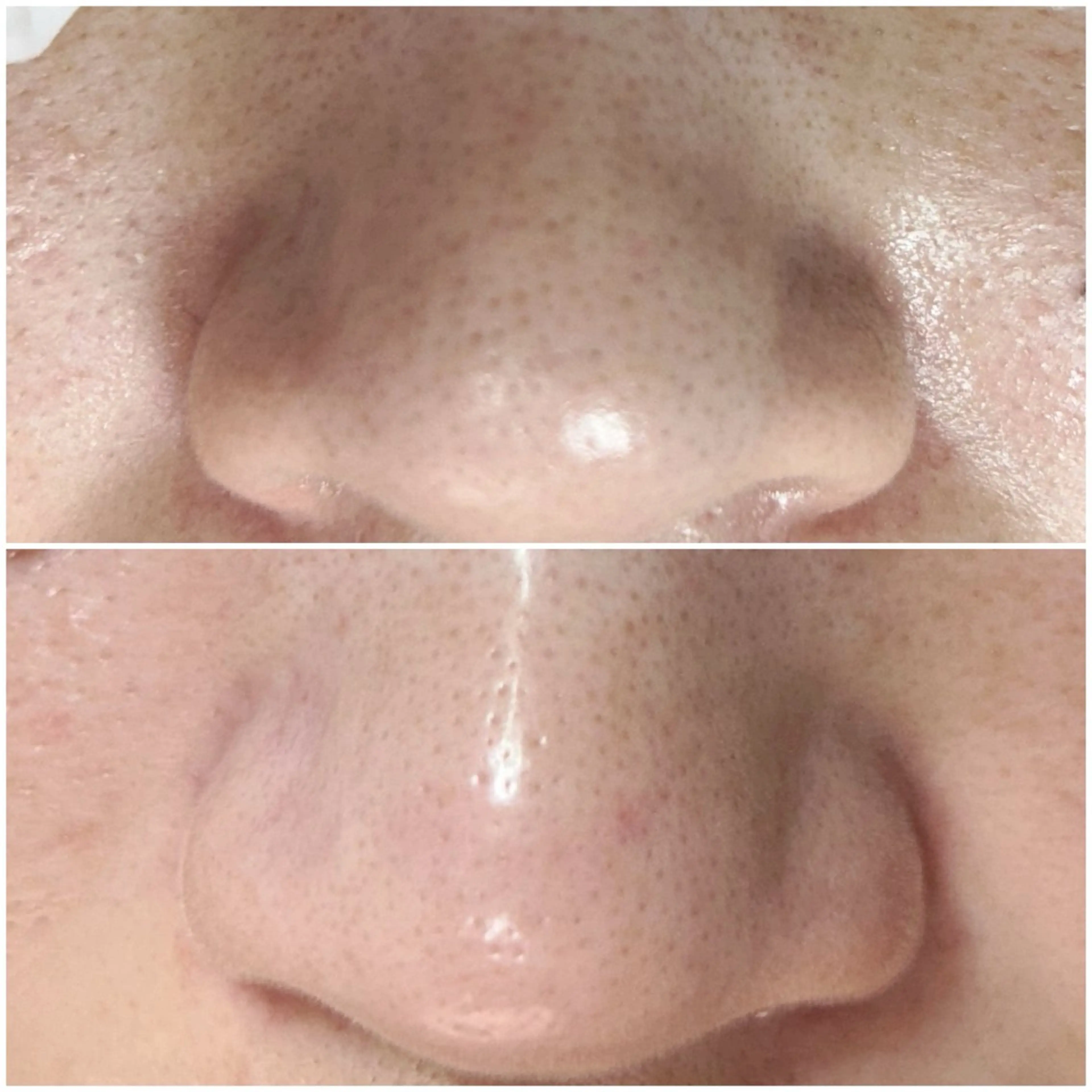 毛穴洗浄専門店/ 泉佐野/oluoluのエステ・リラクイメージ