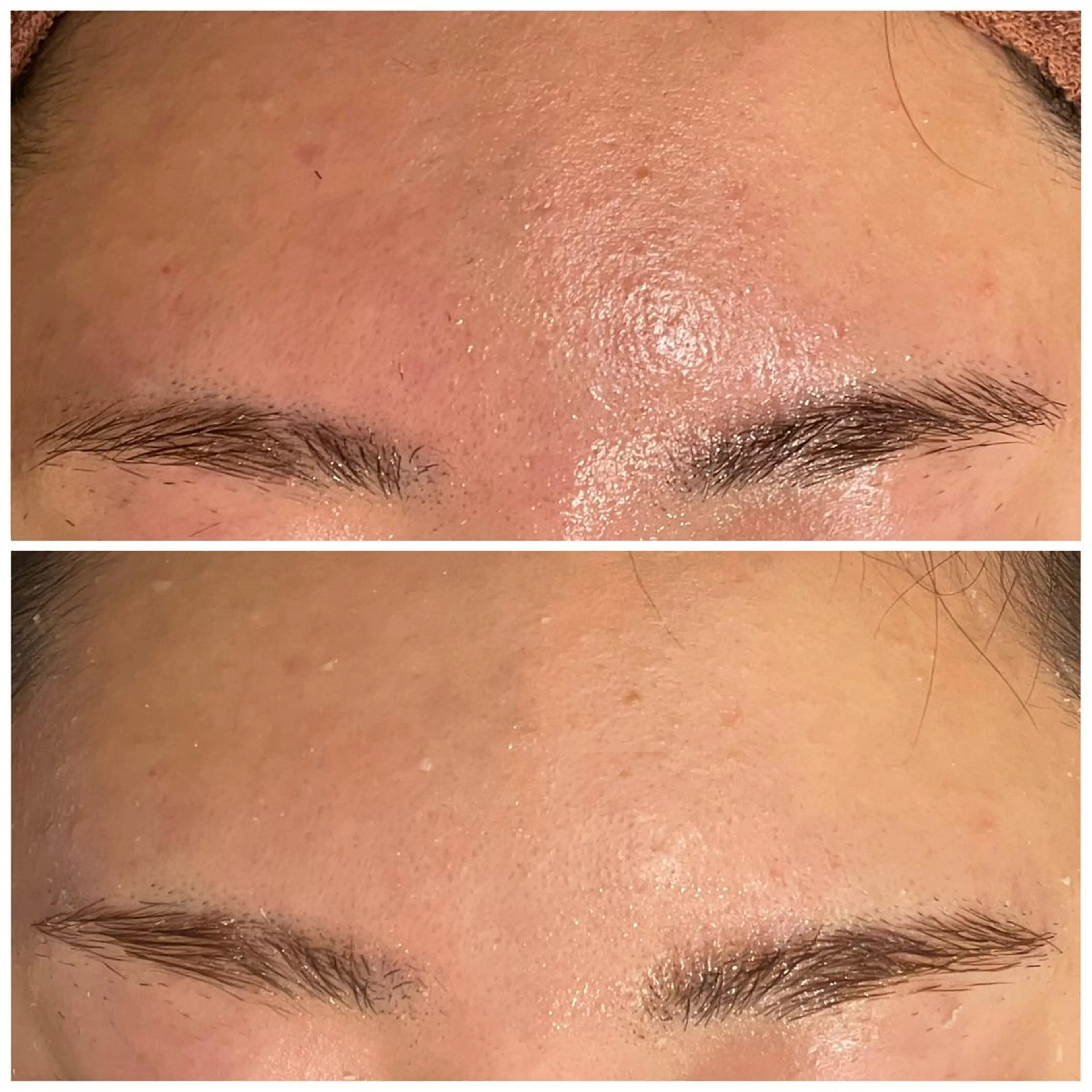 セミロング カラー パーマ ヘアアレンジ メンズ ネイル マツエク・マツパ アイブロウ 3か月で肌革命👼 ニキビ専門店💫のエステ・リラクイメージ