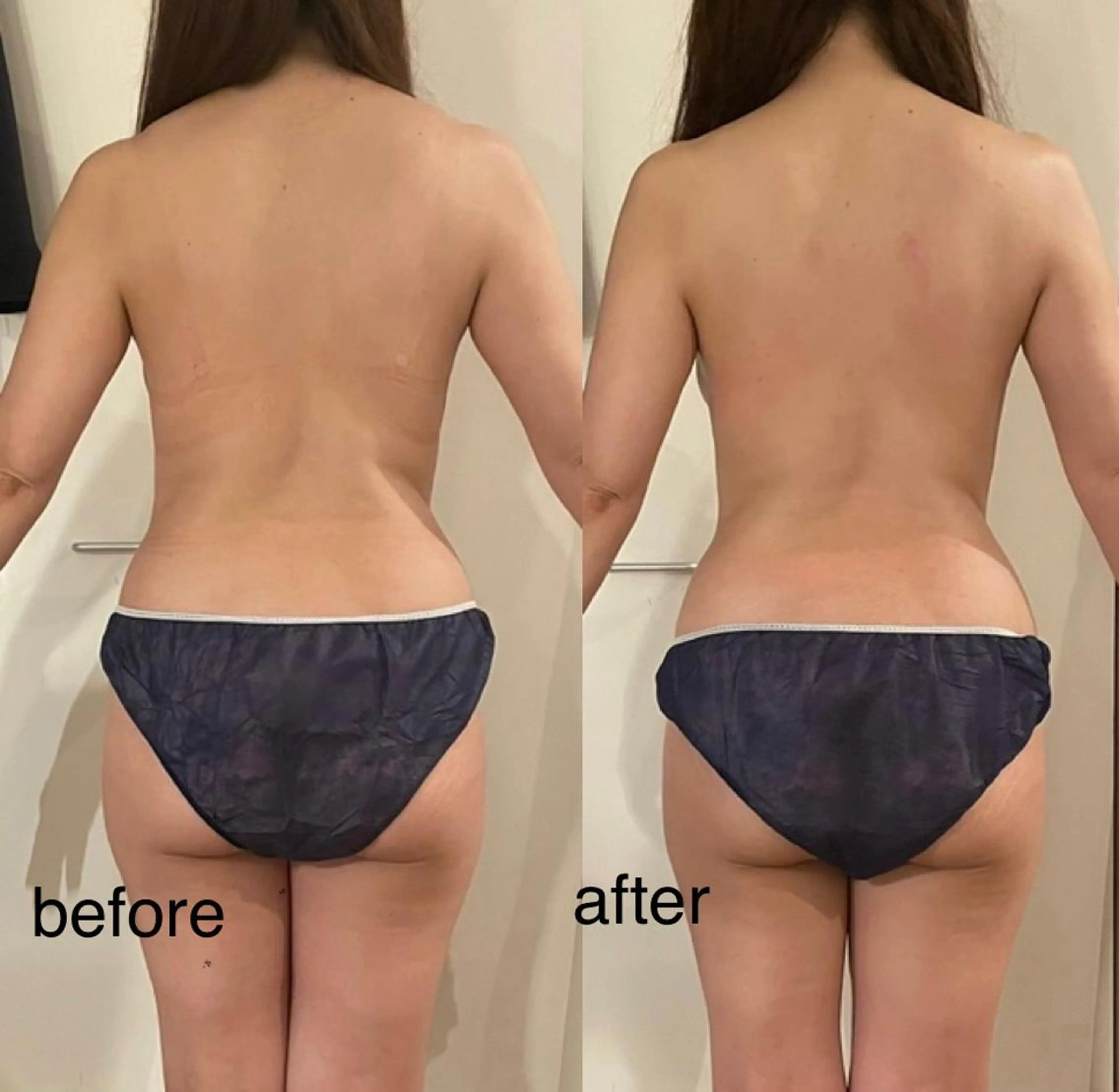 エステ リラク プライベートサロン シュシュのエステ・リラクイメージ