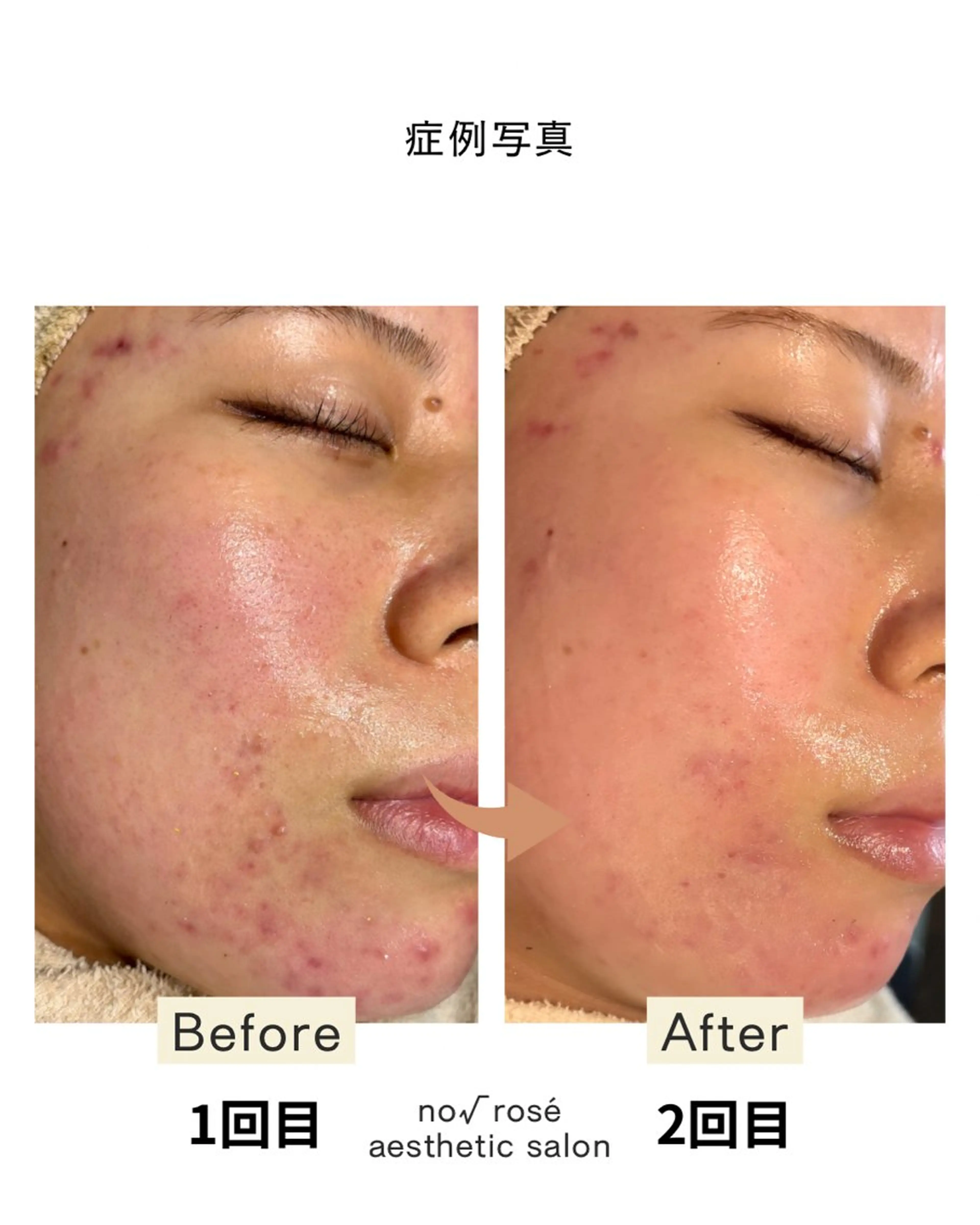 エステ ノールート ロゼのエステ・リラクイメージ