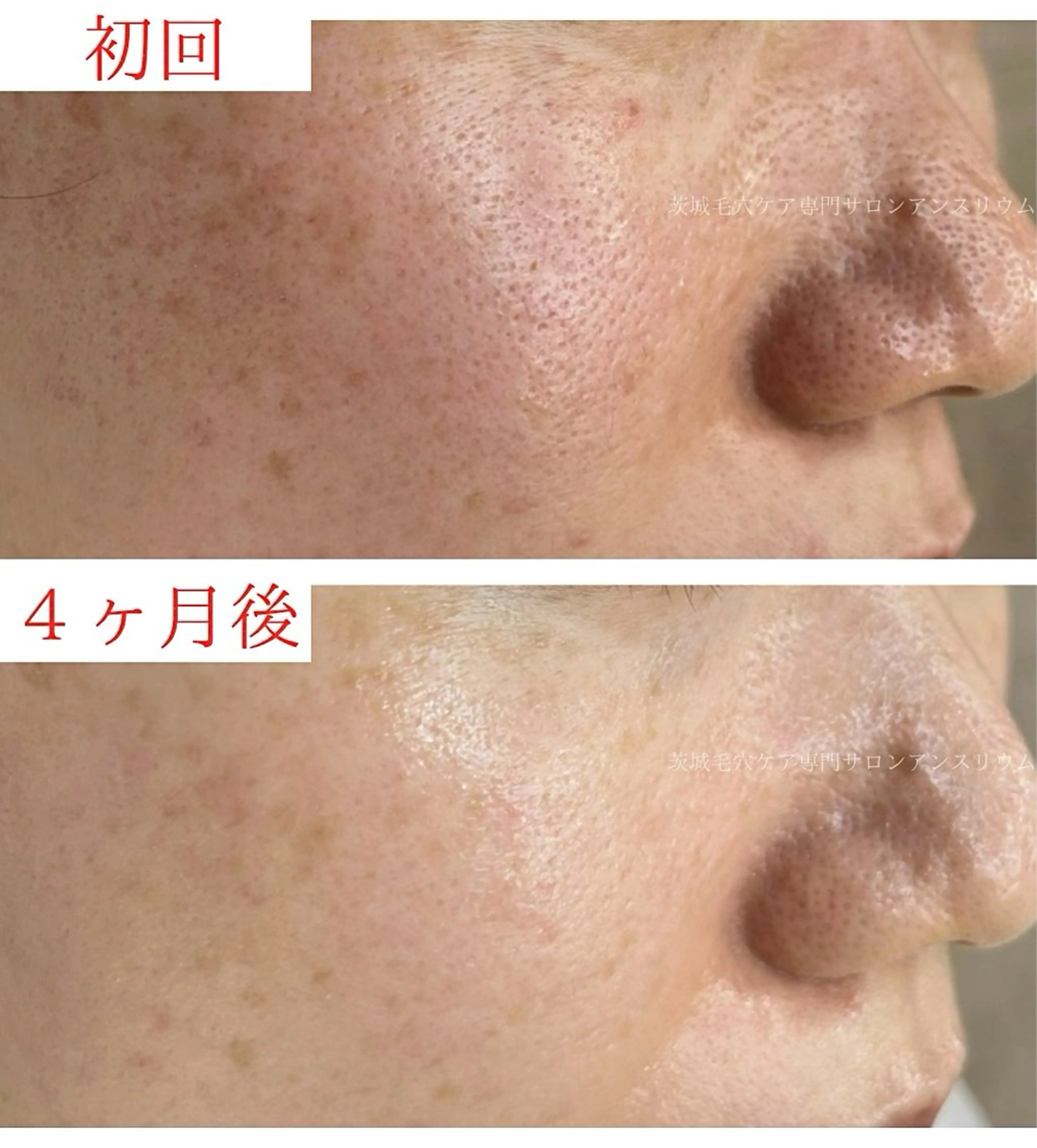 茨城土浦 つくば毛穴 ケア専門サロンのエステ・リラクイメージ