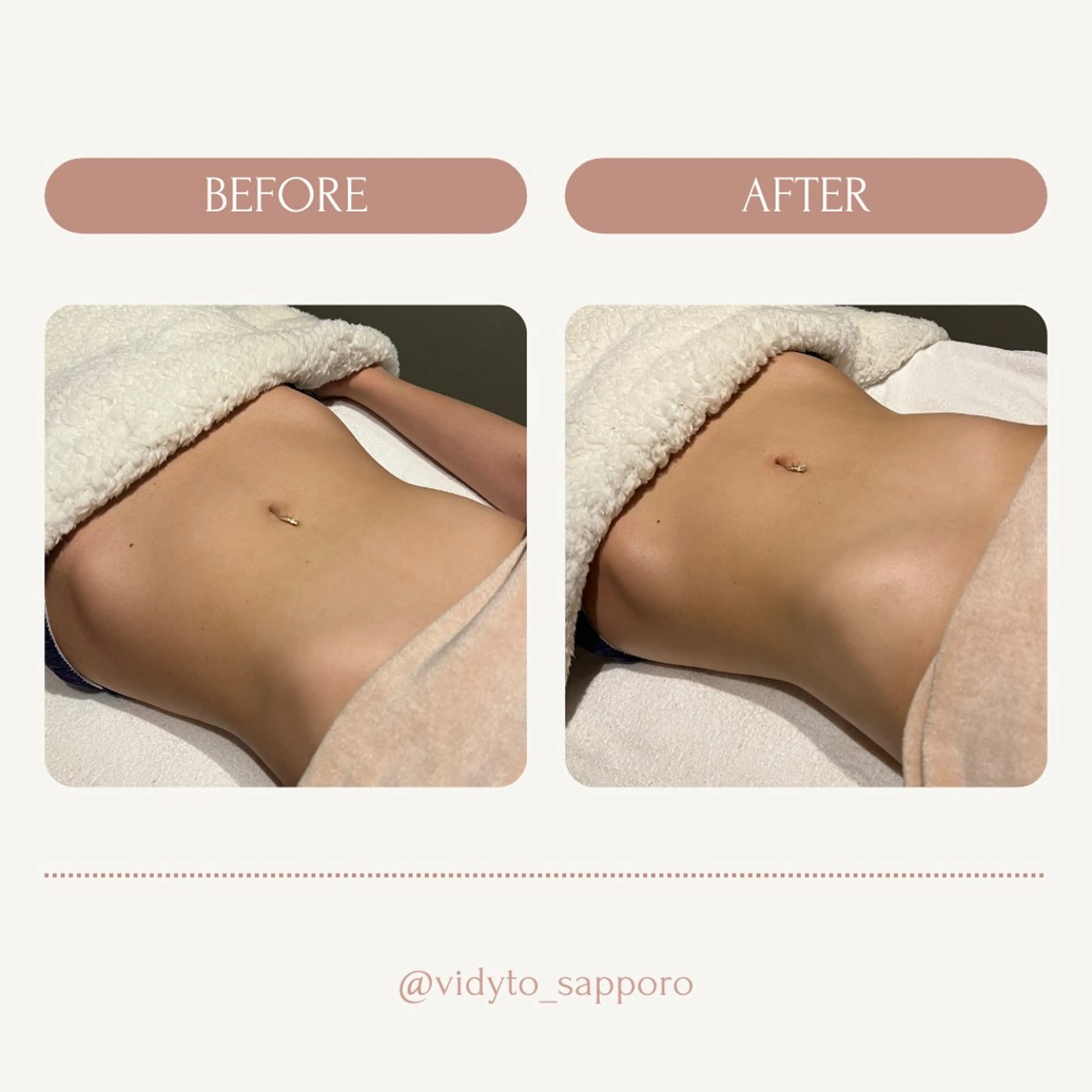 【vidyto】ヴィディトゥ所属・肌管理サロン vidyto MOEのエステ・リラクイメージ