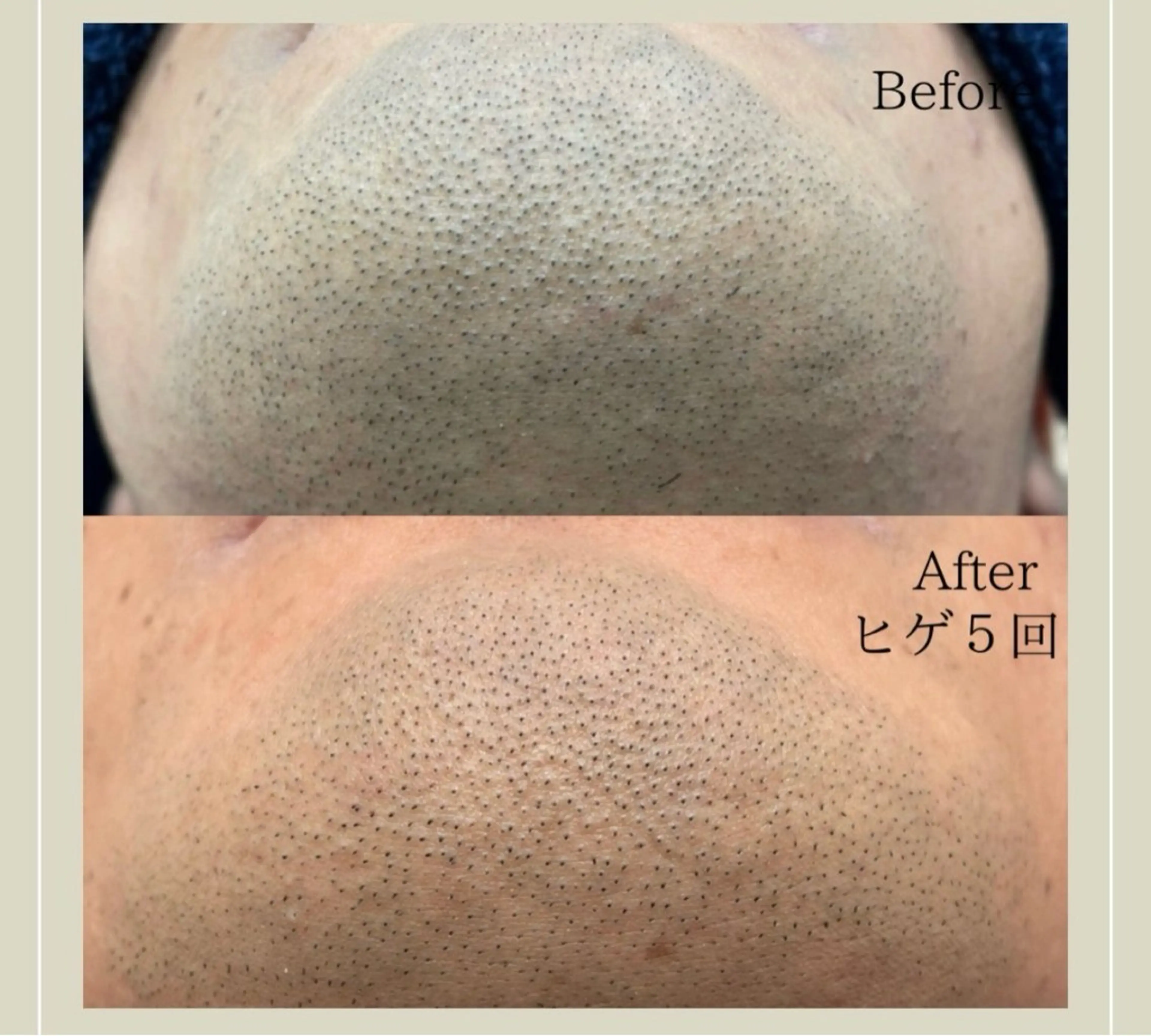 メンズ chareir homme菅原のその他イメージ