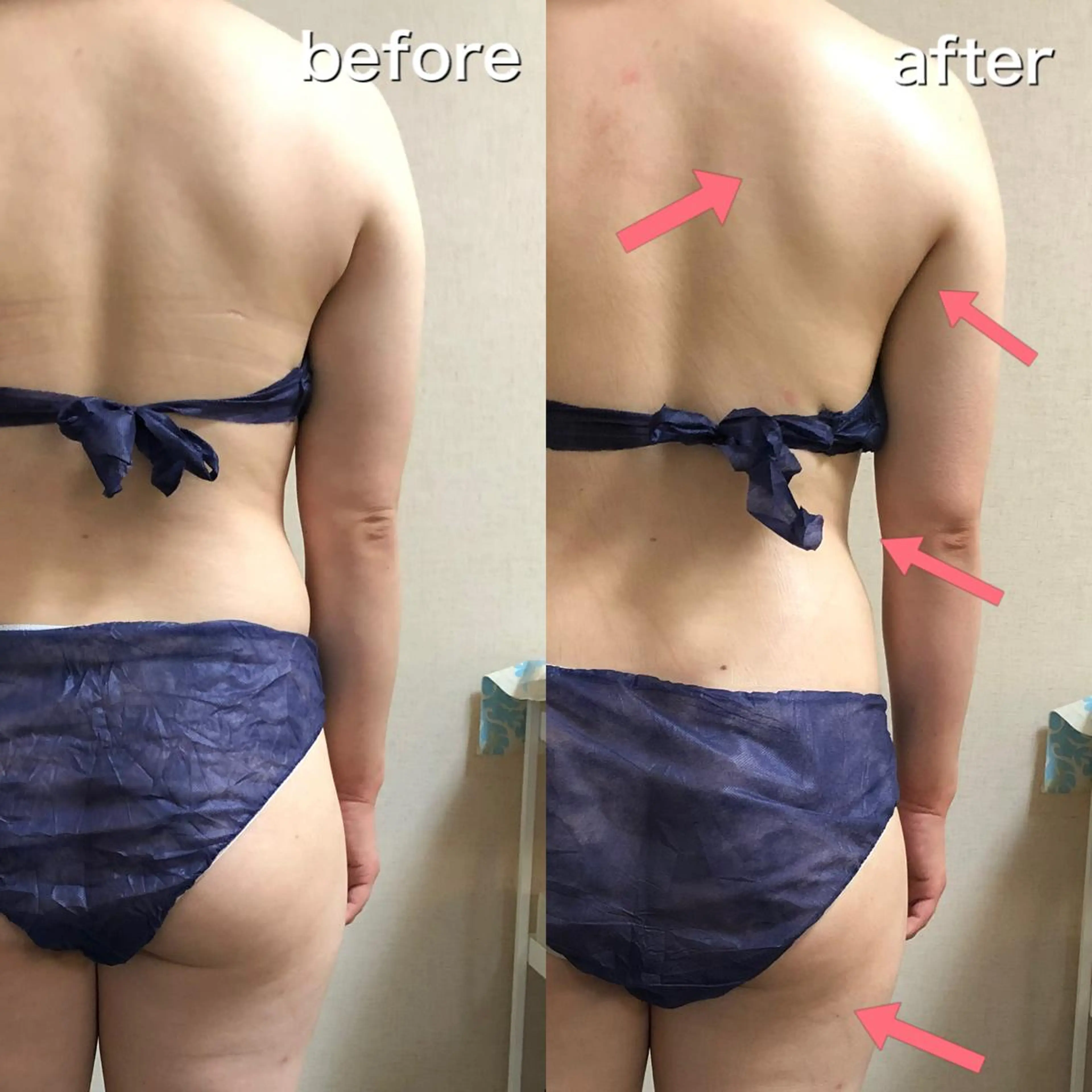 Melia所属・仲田 幸恵のエステ・リラクイメージ