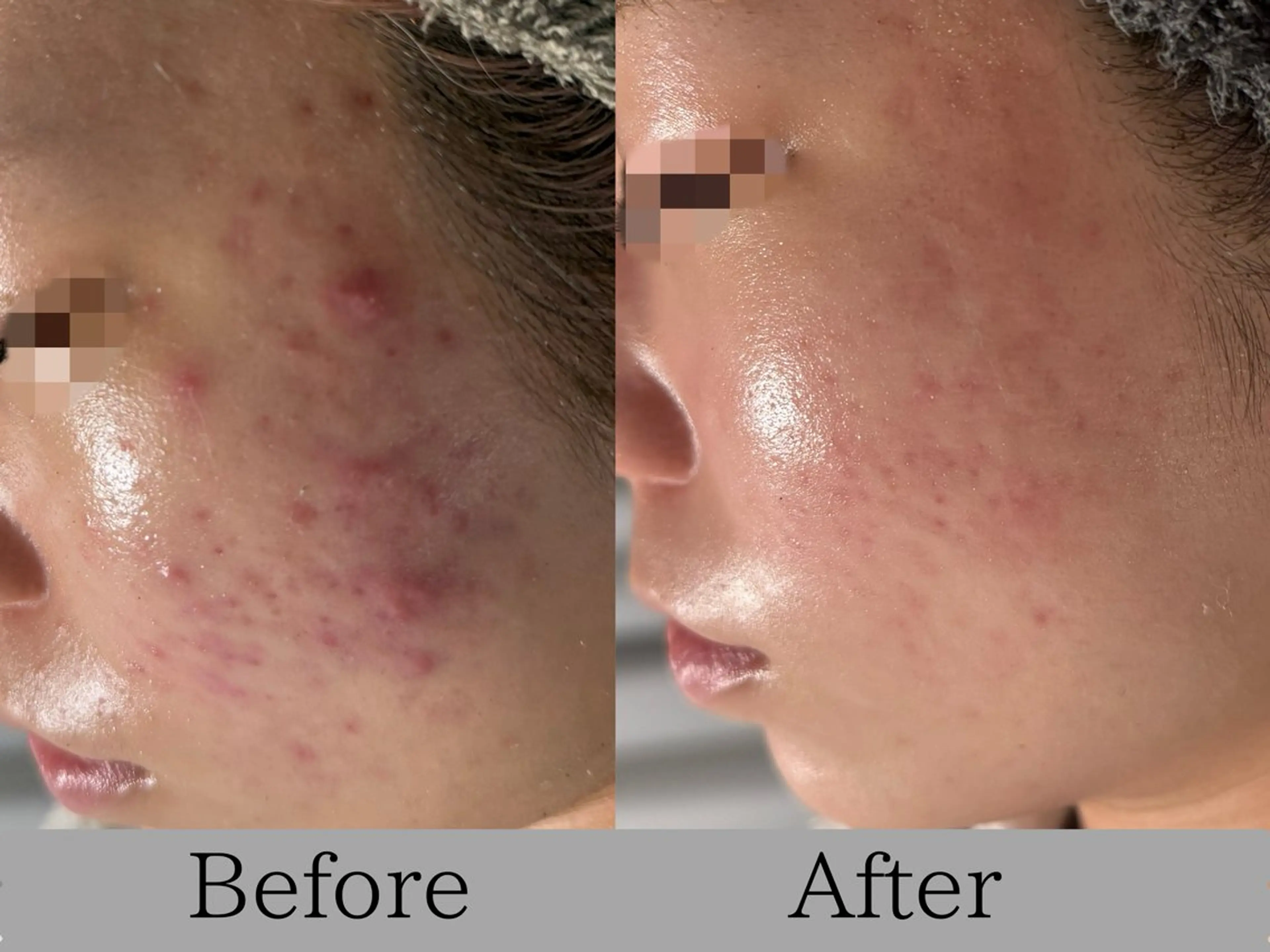 エステ リラク lumi riseのエステ・リラクイメージ