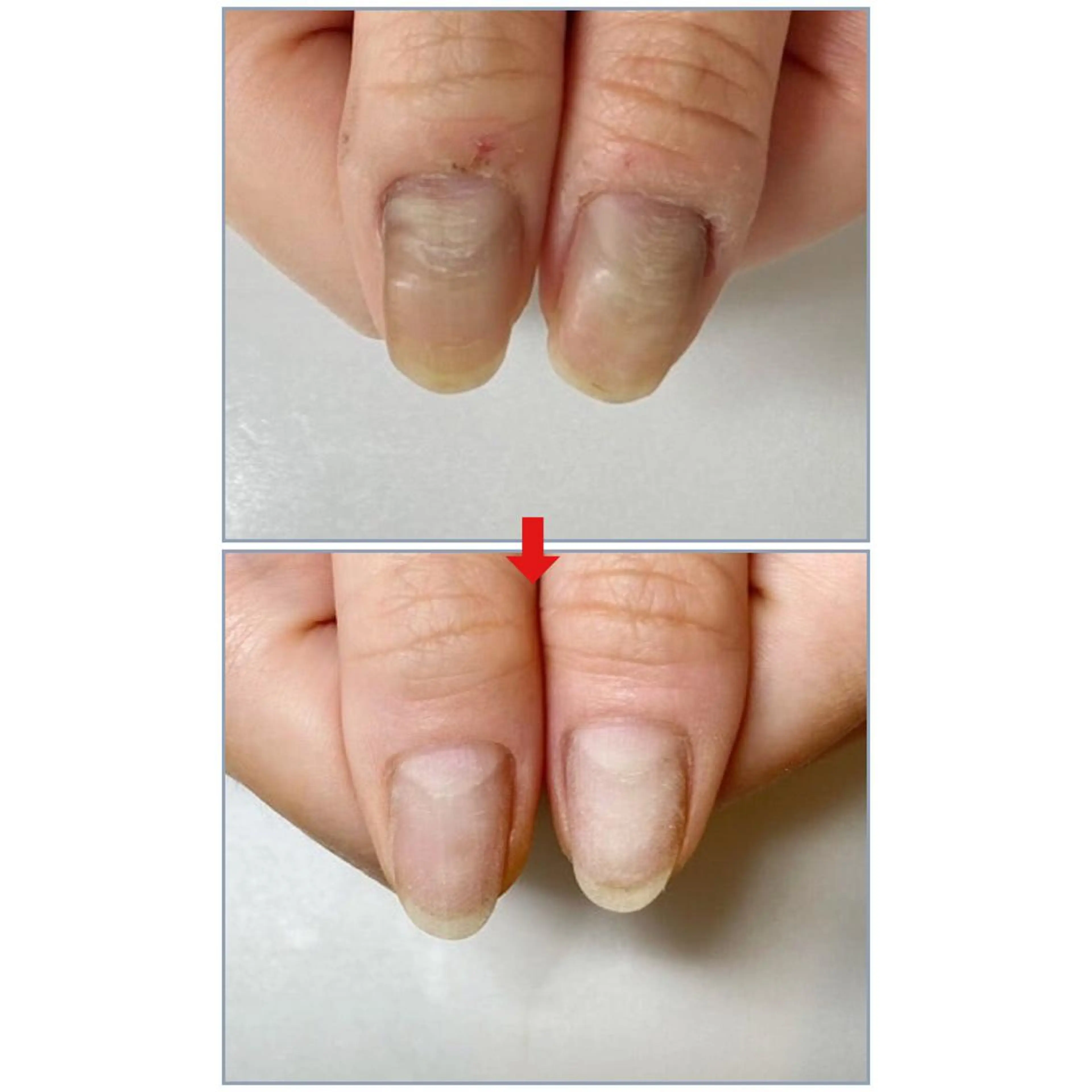 ネイル ネイルサロンアリューム所属・ネイルサロン アリュームのネイルデザイン