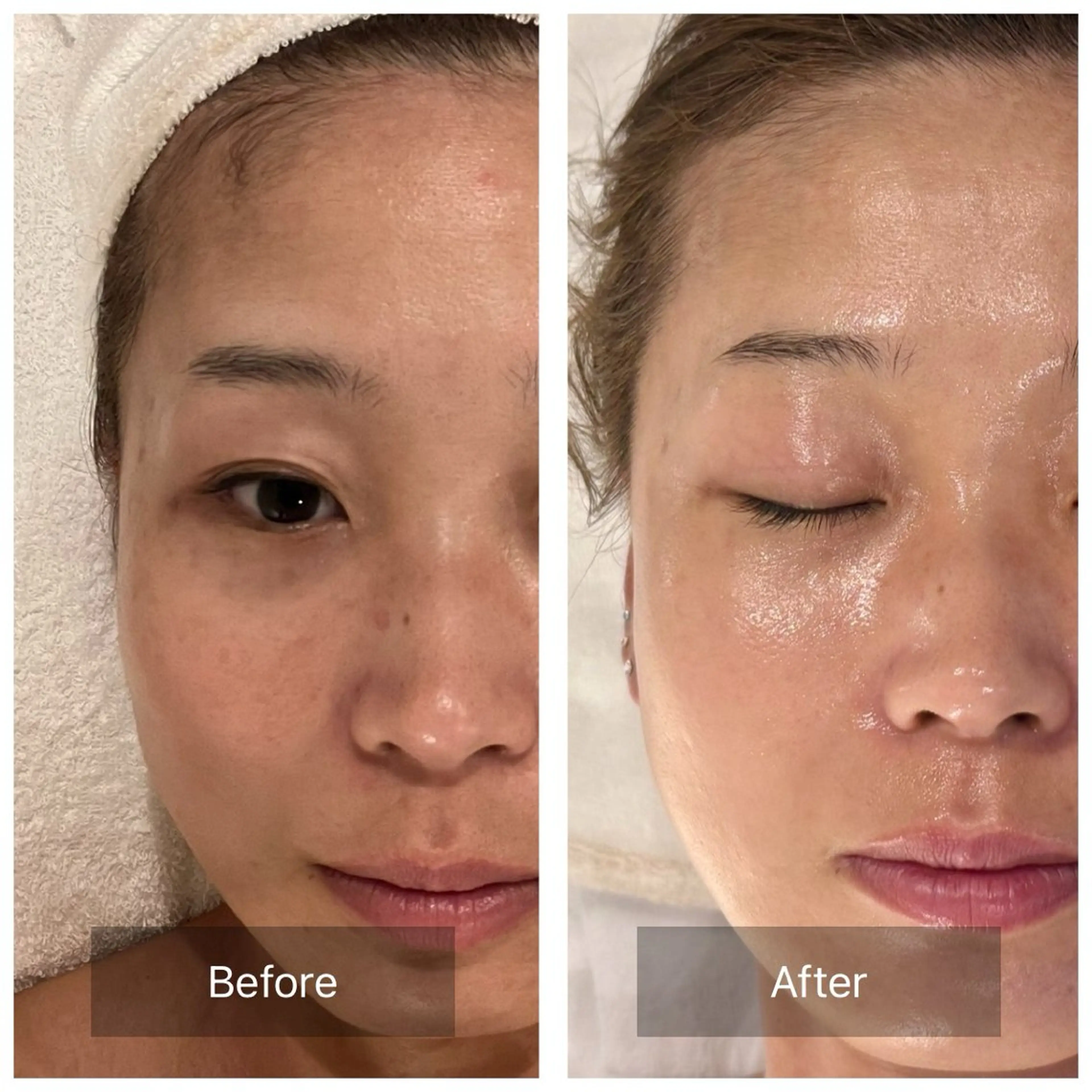 エステ mine.mi マインエムのエステ・リラクイメージ