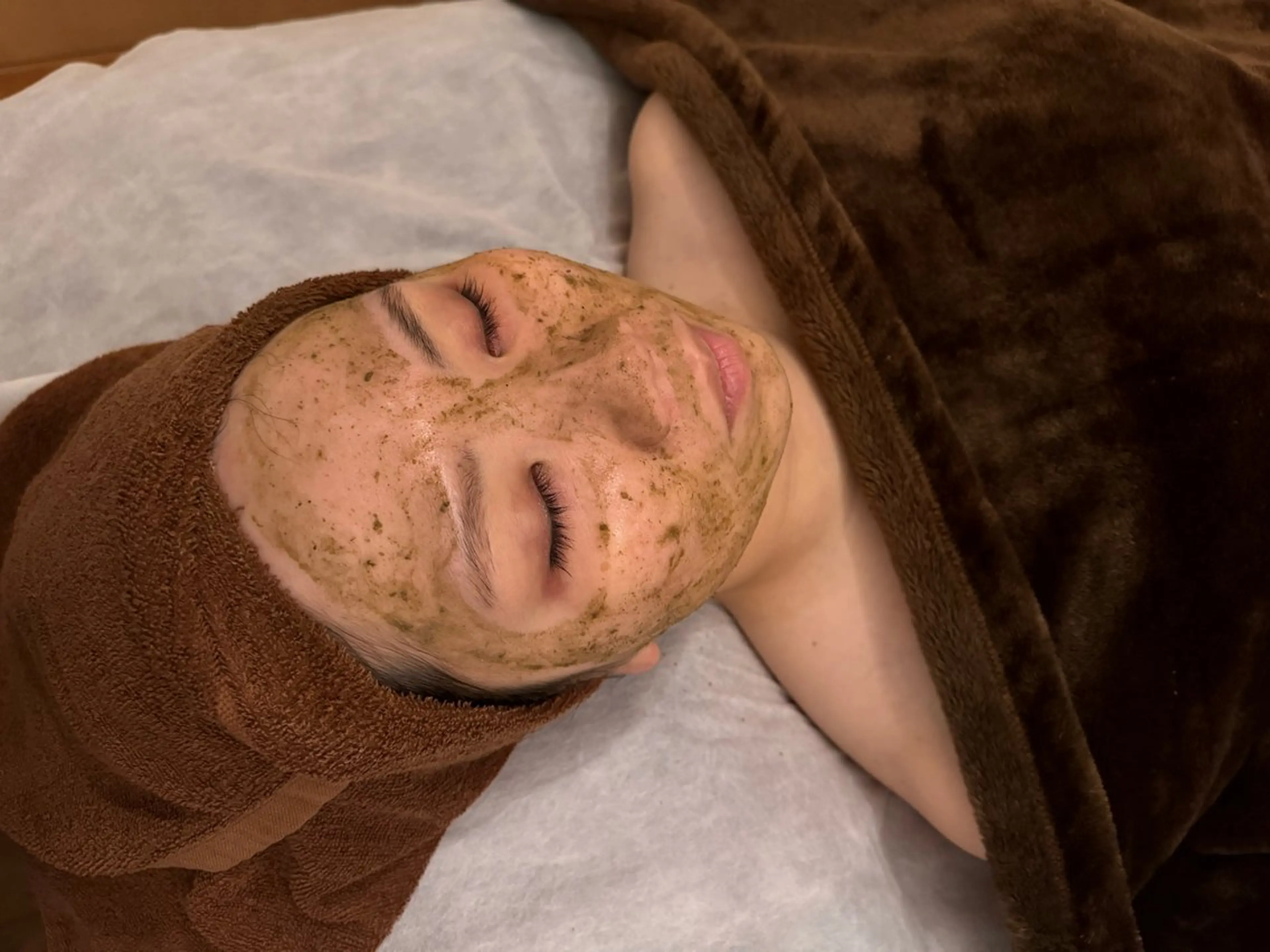 憧れの艶肌"ハーブピーリング"の写真