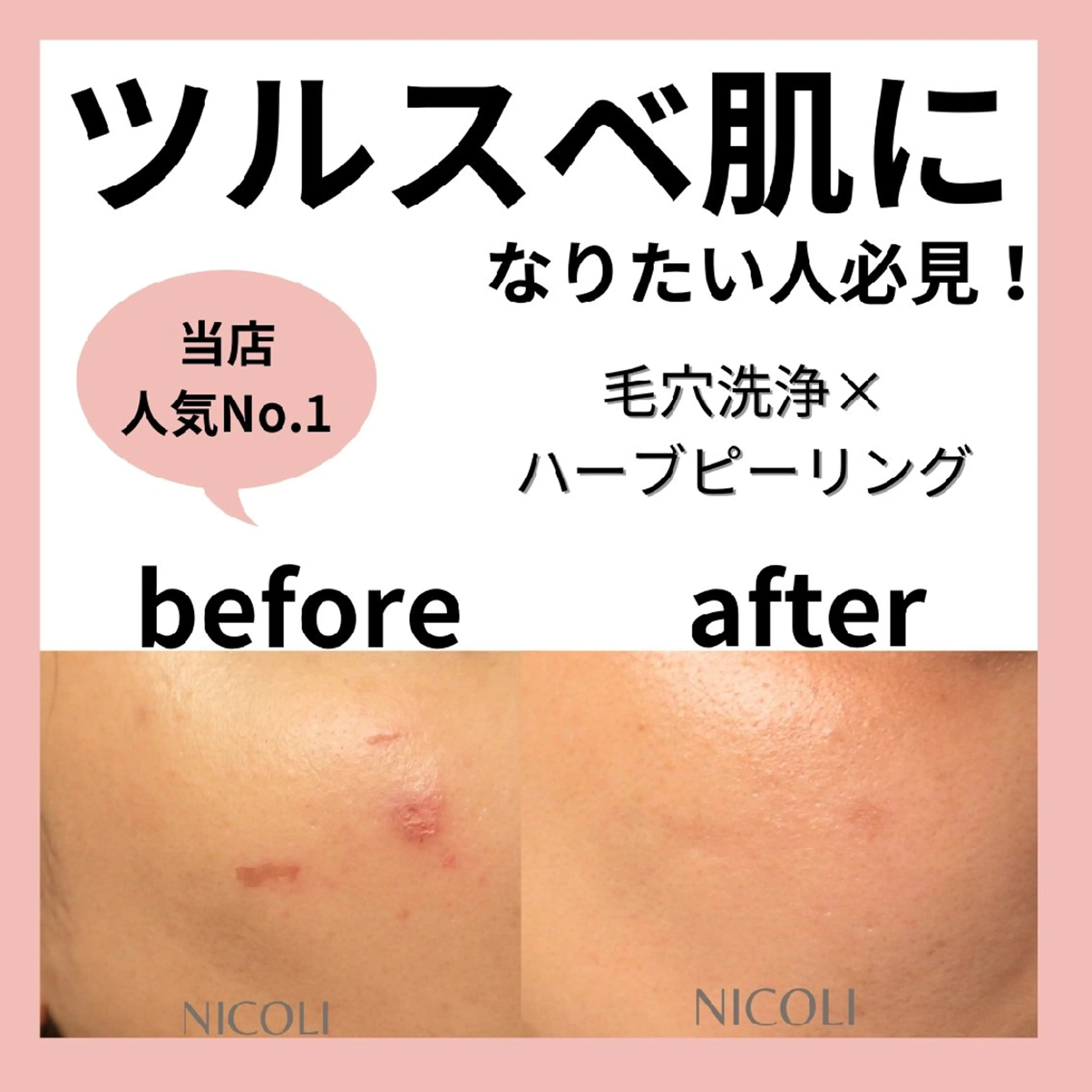 エステサロン NICOLIのエステ・リラクイメージ