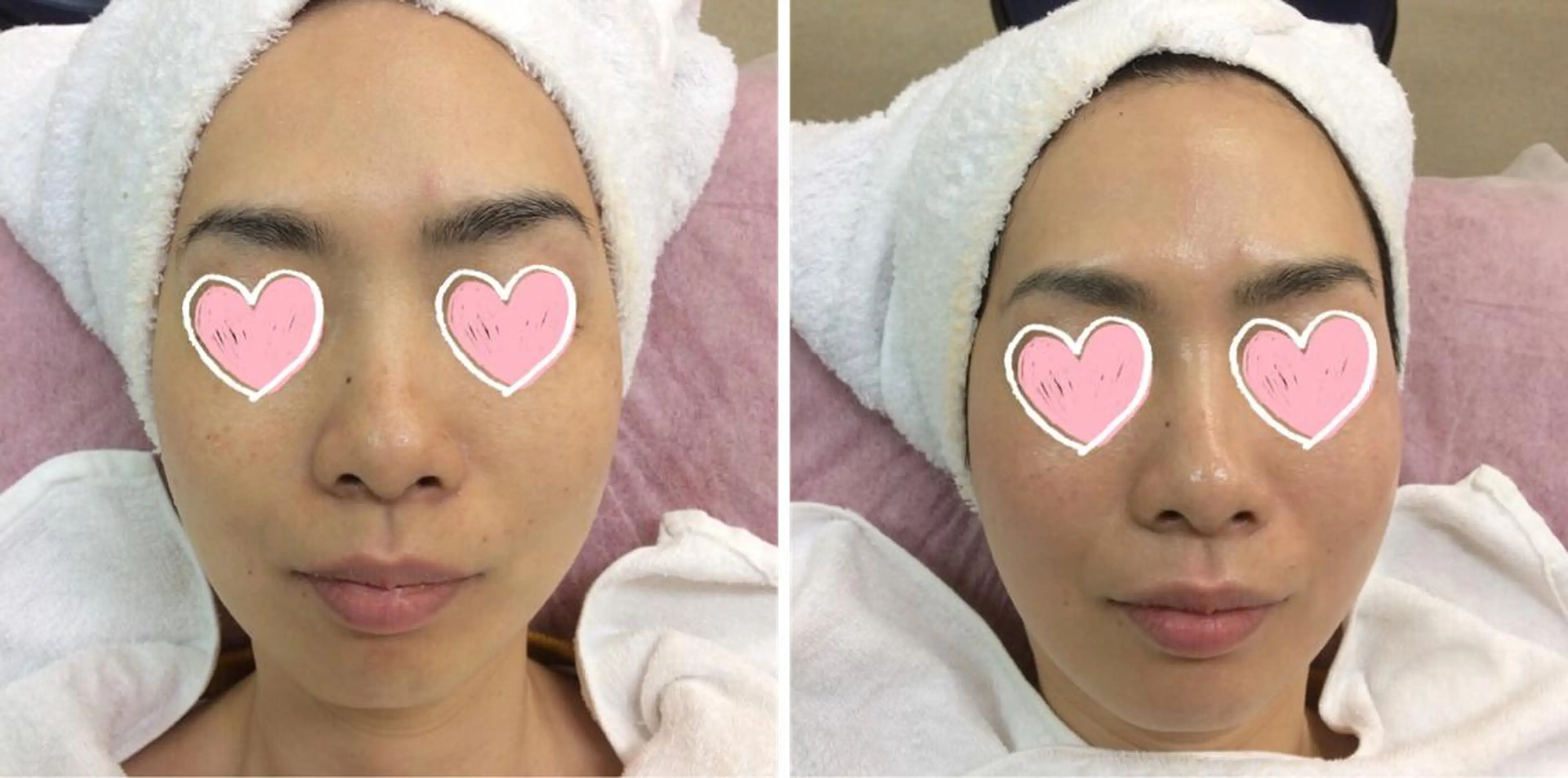 脱毛 鈴木 直子のエステ・リラクイメージ