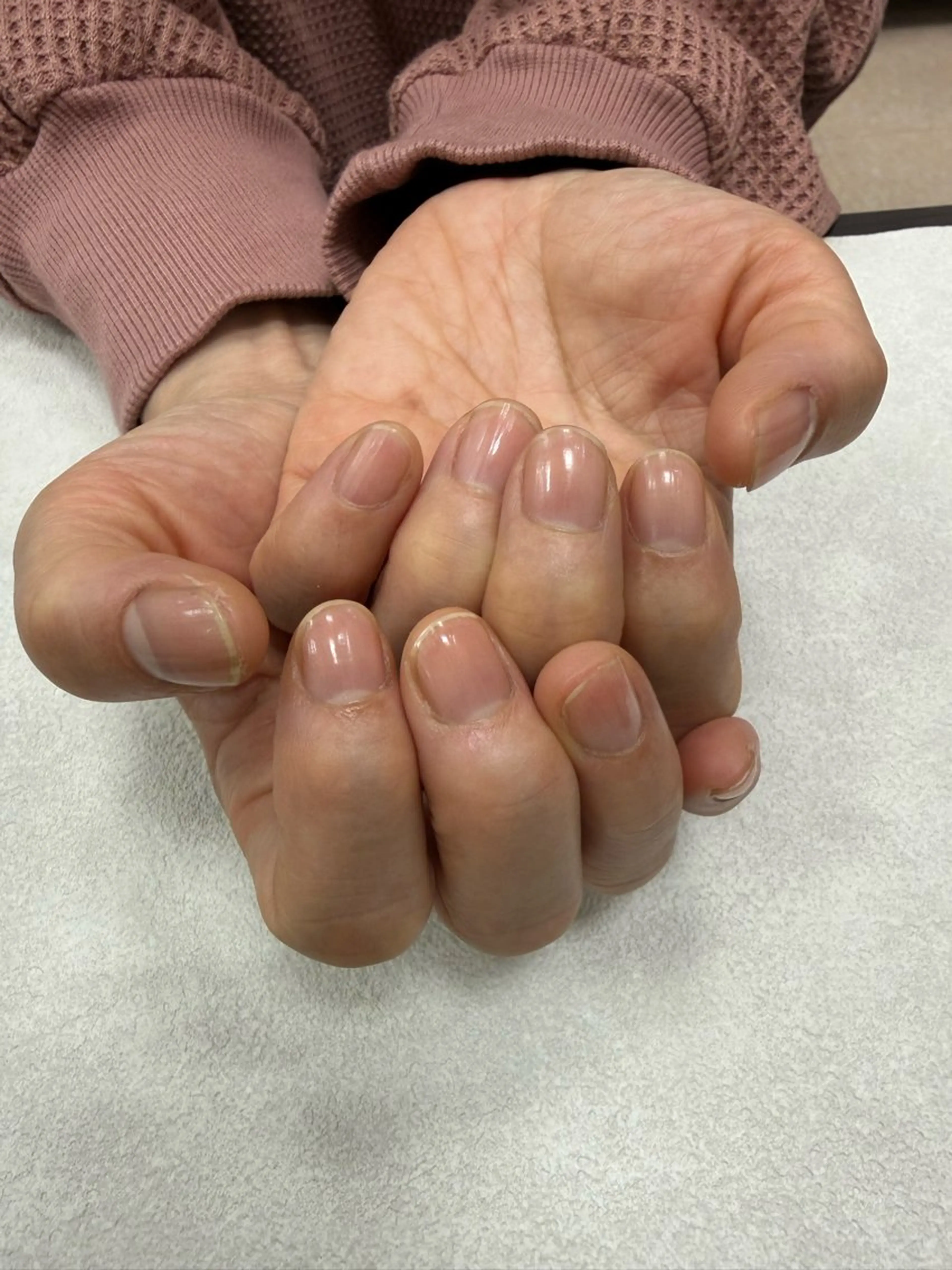 ハンドケアの写真