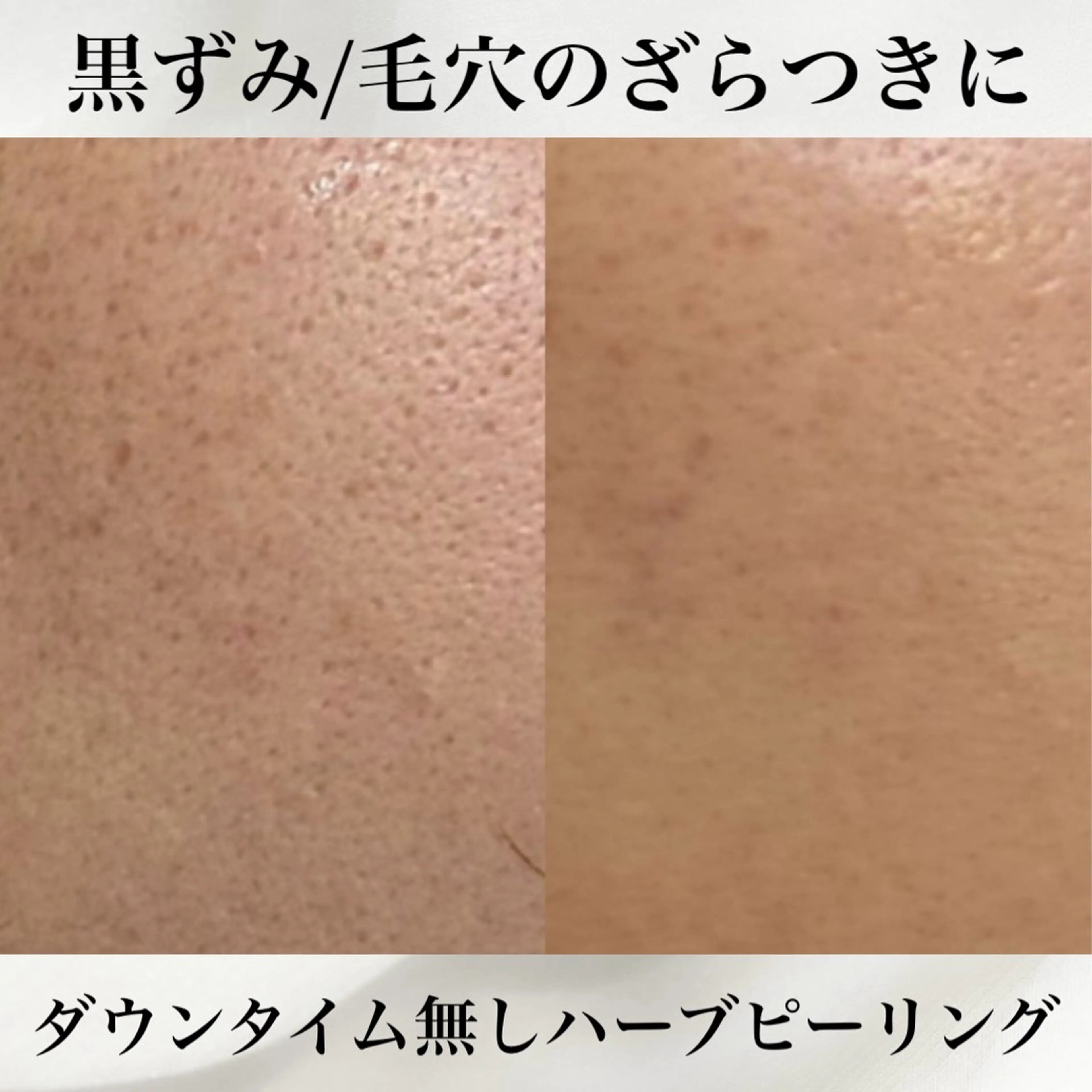 エステ 肌質改善×癒しサロン Bell skinのエステ・リラクイメージ