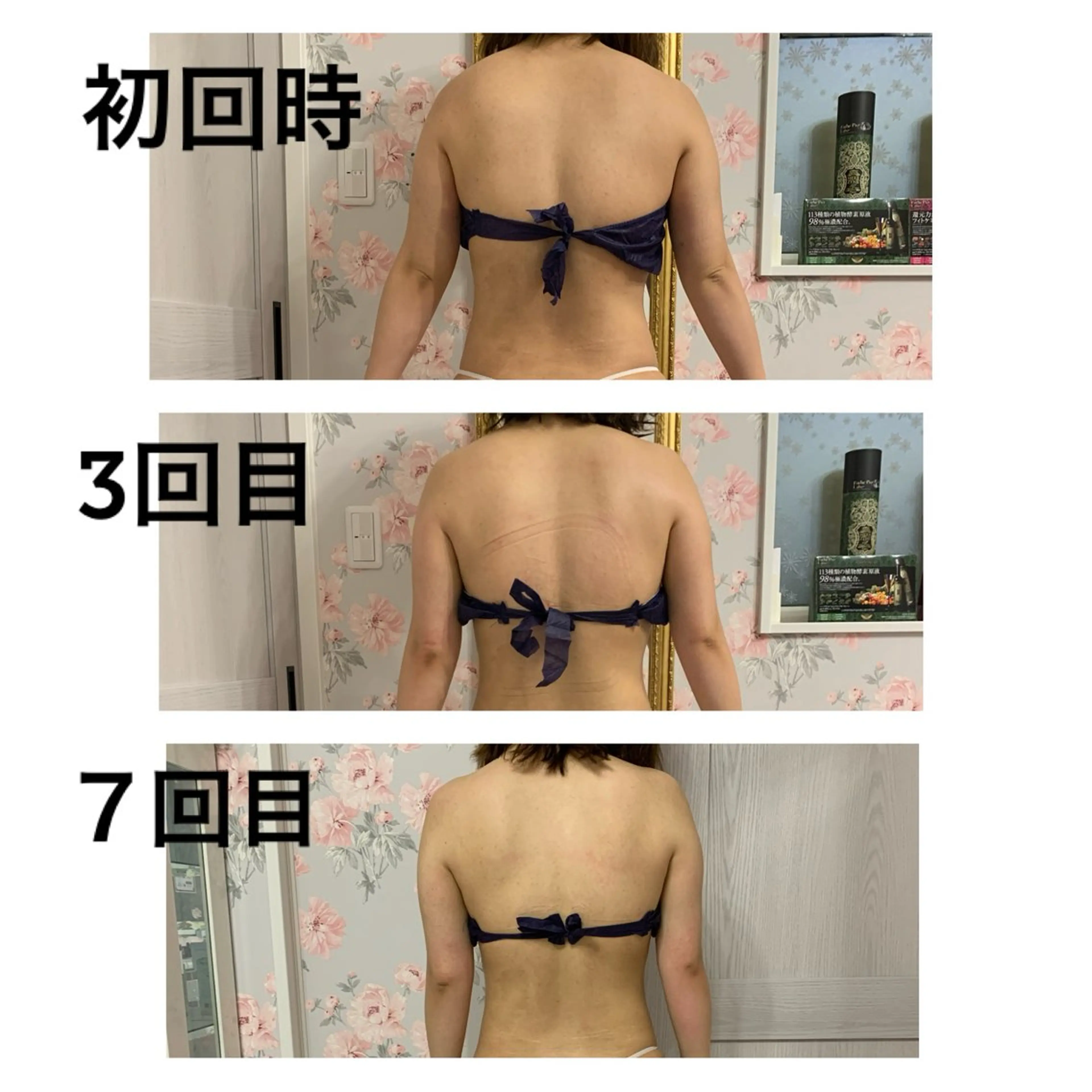 Snow Whiteのエステ・リラクイメージ