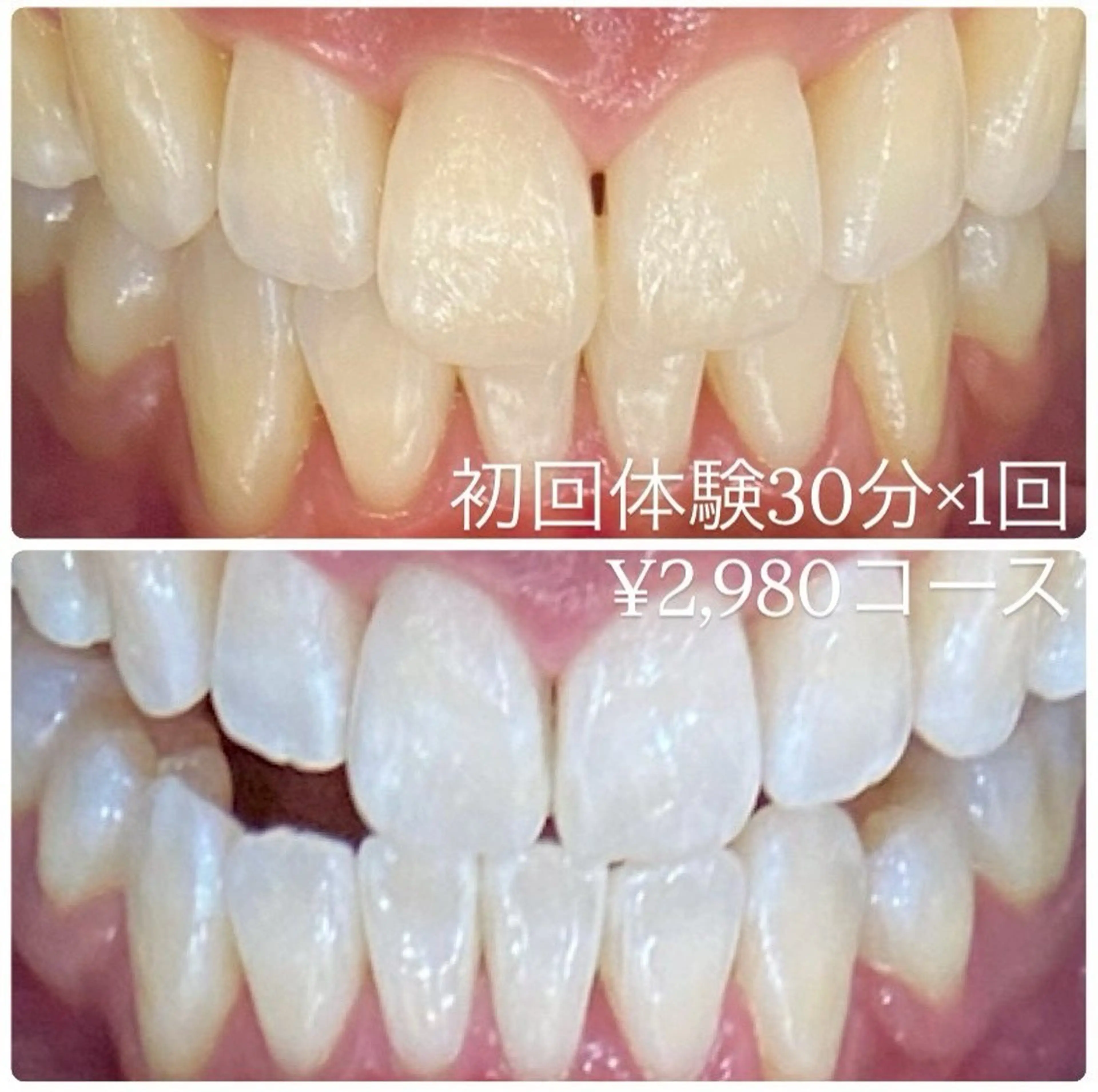 メンズ ホワイトニングルーム 川崎店所属・ホワイトニング ルーム 川崎店のその他イメージ