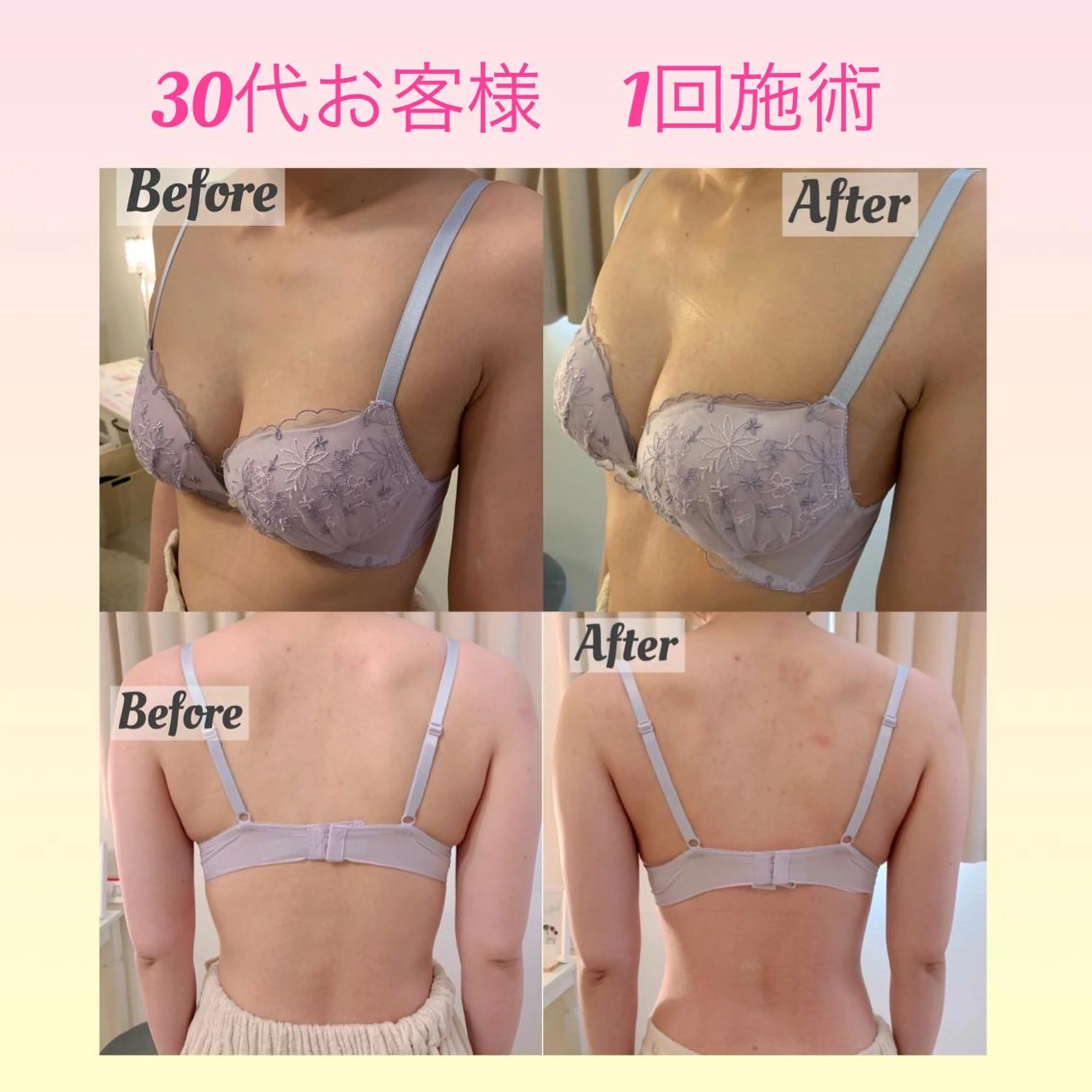 Ele’na バスト&フェイシャルのエステ・リラクイメージ