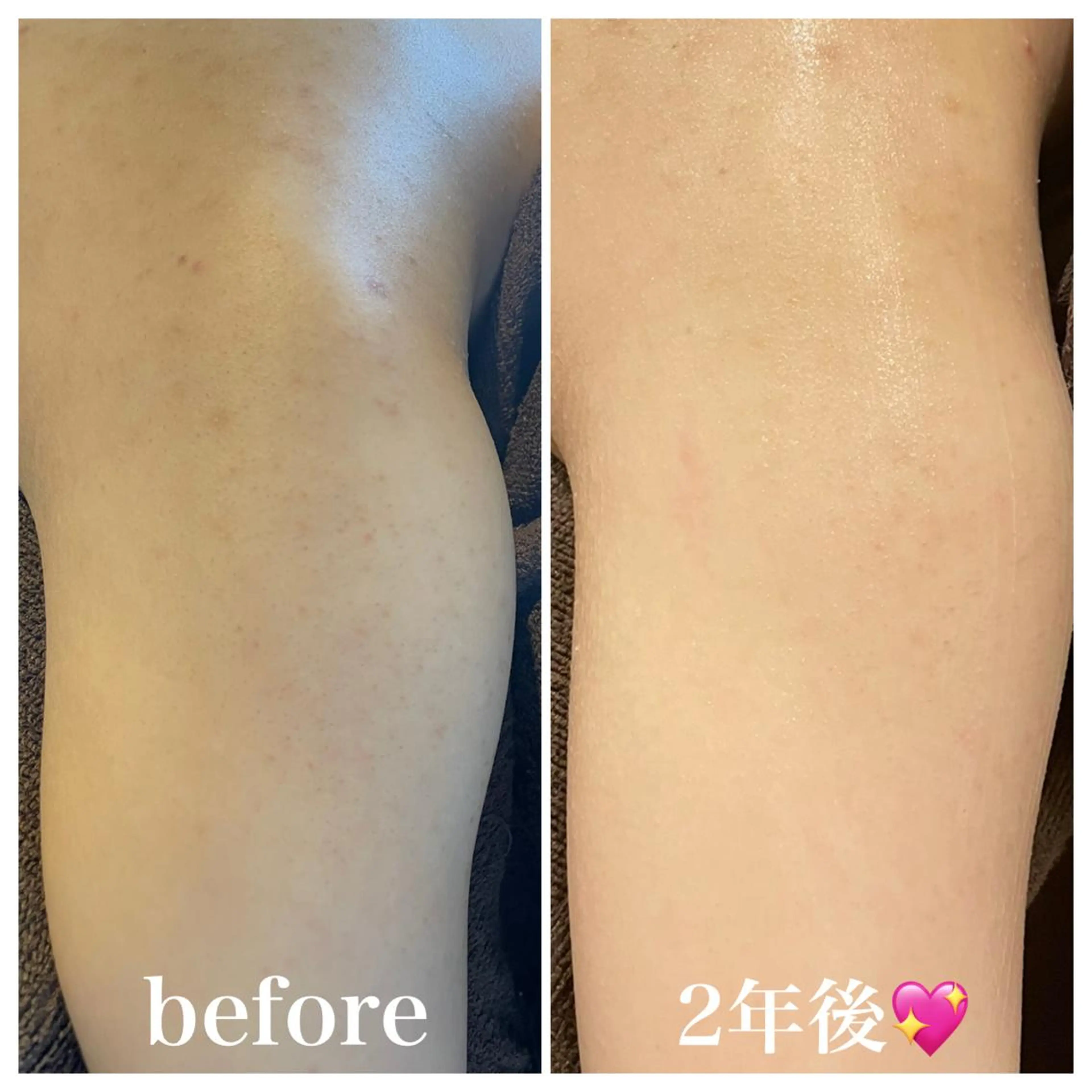 エステ 浜野 恵美のエステ・リラクイメージ