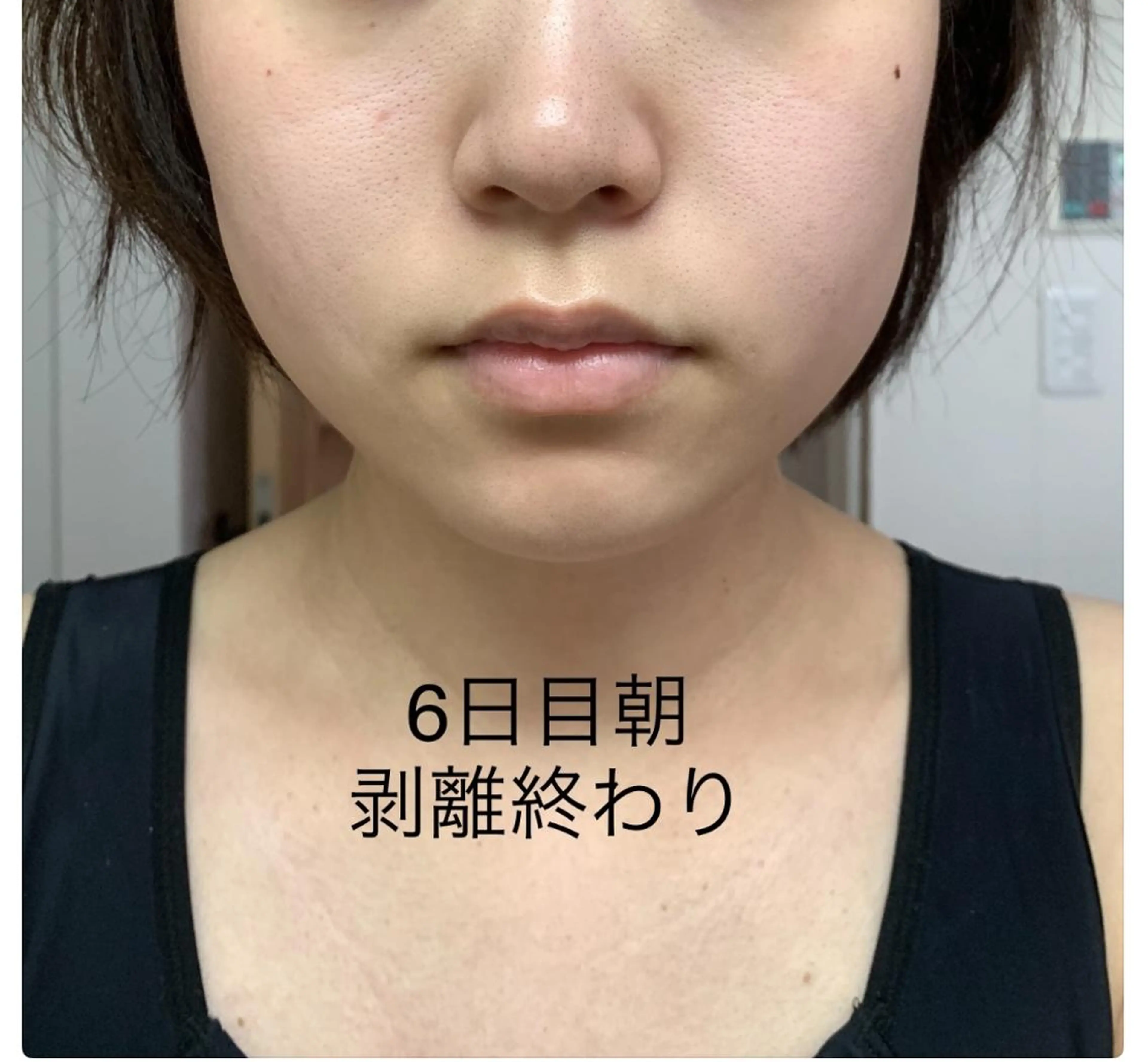 エステ リラク エステティック RAYVIS池袋🐱のエステ・リラクイメージ