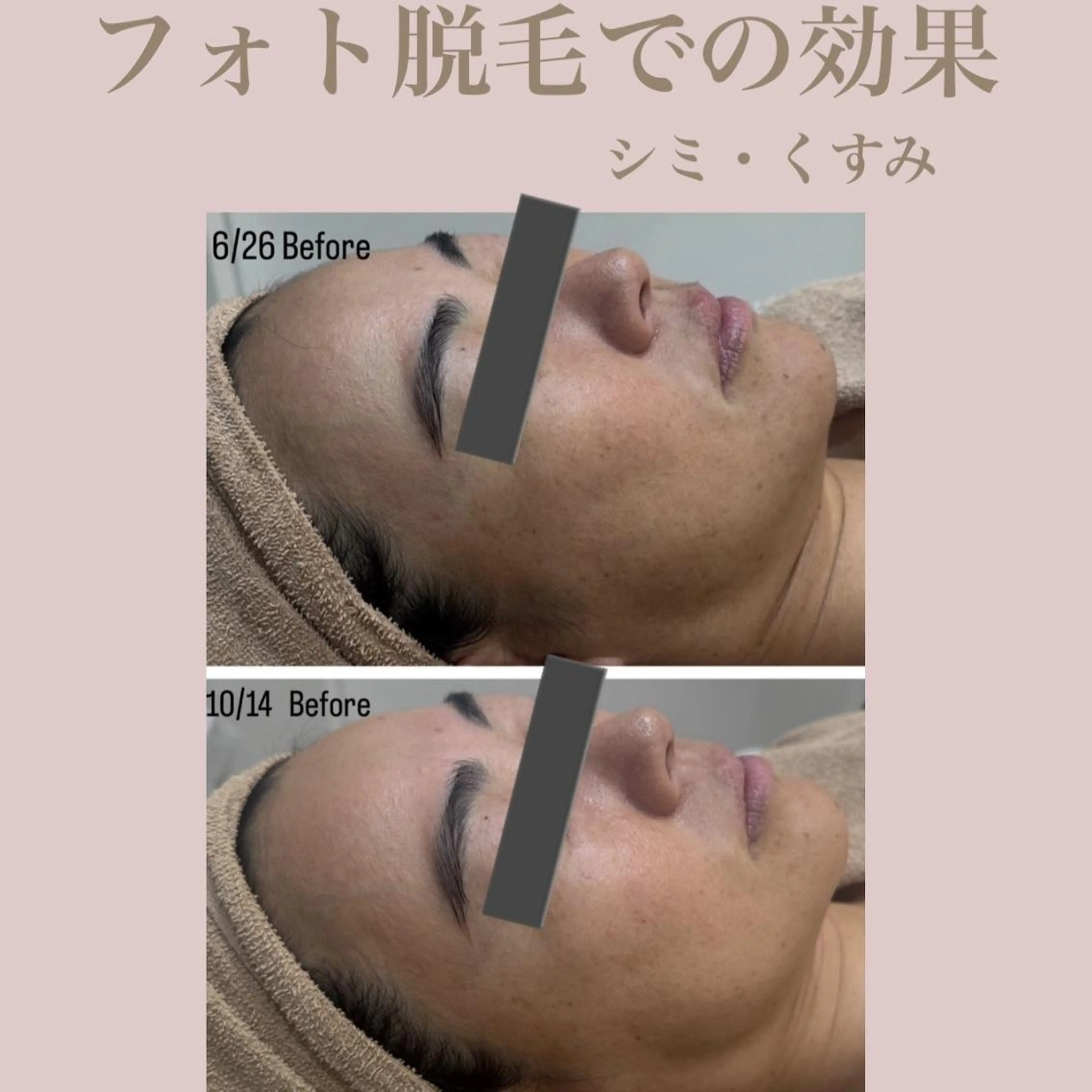 🤍Linola🤍 レイビス 須藤のエステ・リラクイメージ