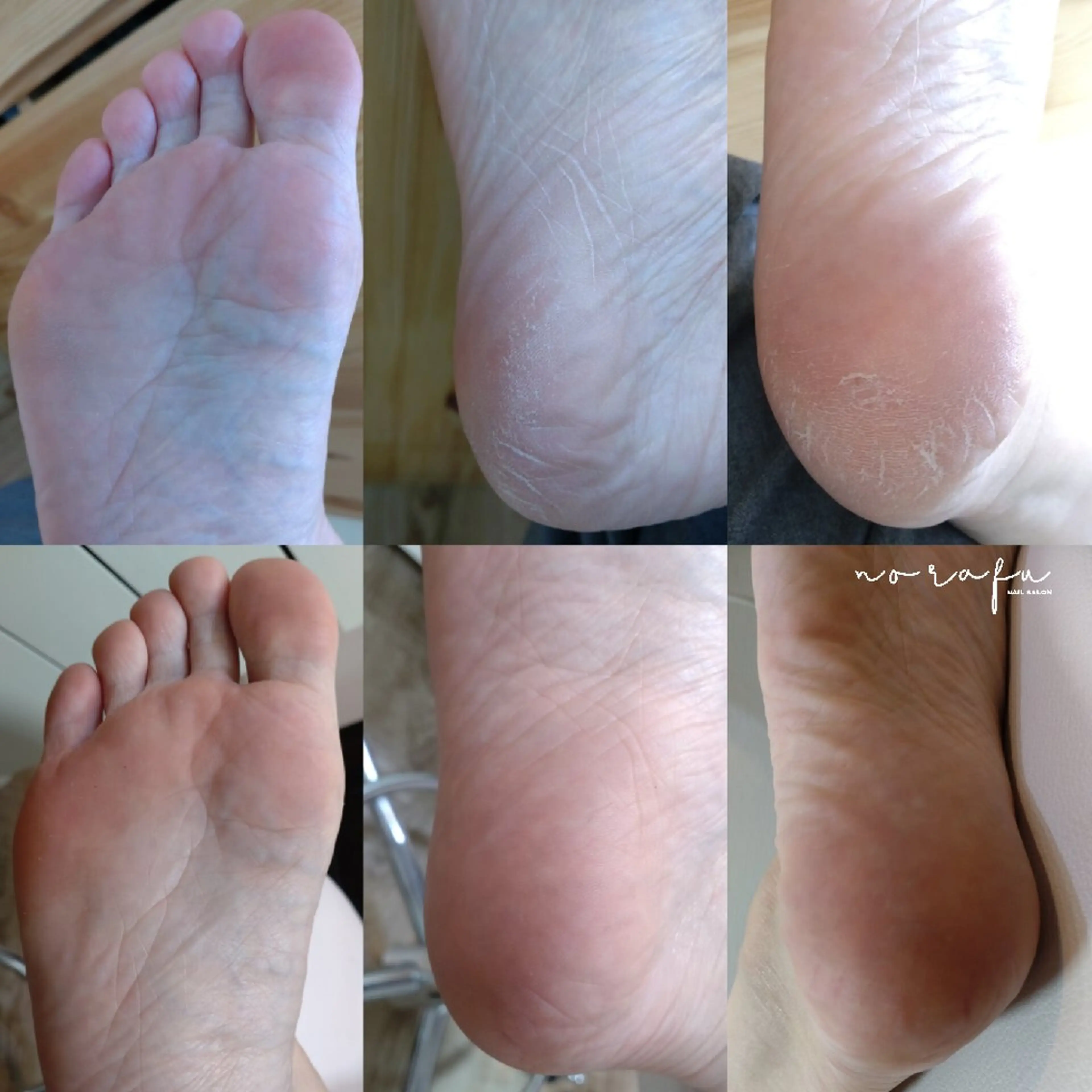 ネイル フットネイル nail 　norafu.のネイルデザイン