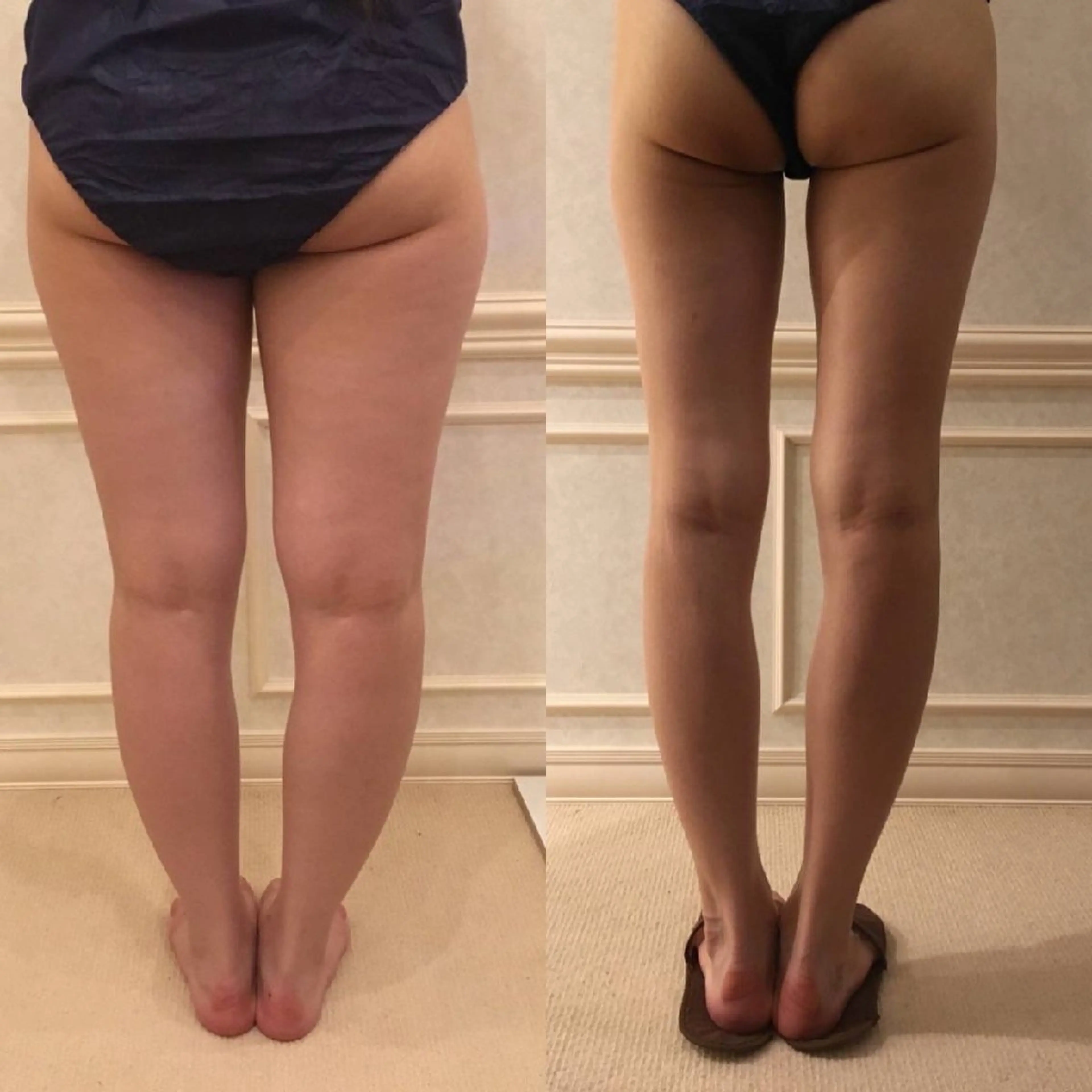 エステ La Luna所属・医療提携サロン新宿 La Lunaのエステ・リラクイメージ