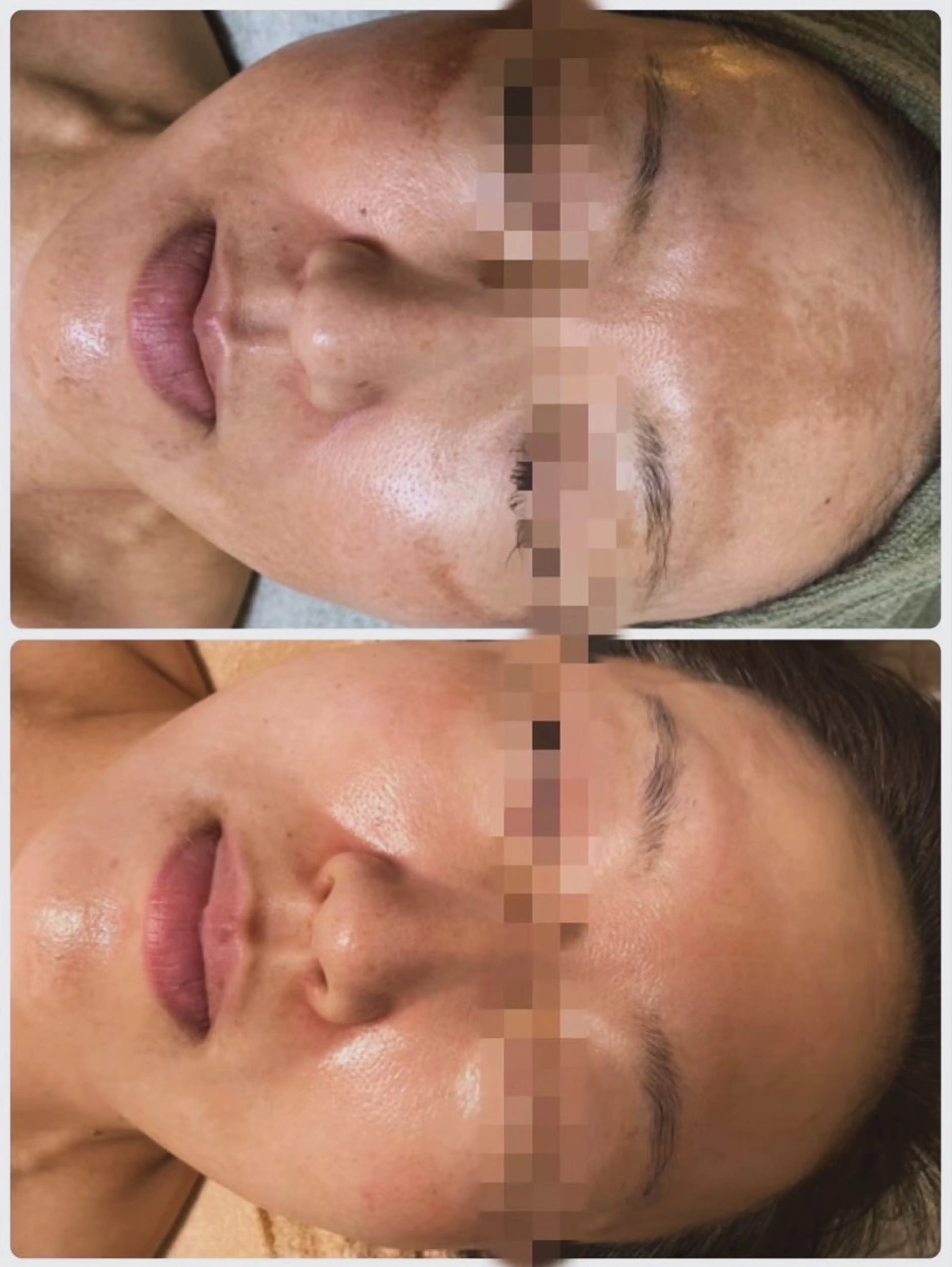 ハーブピーリング　美肌サロン　health and beauty maki所属・ハーブピーリング 美肌サロン　makiのエステ・リラクイメージ