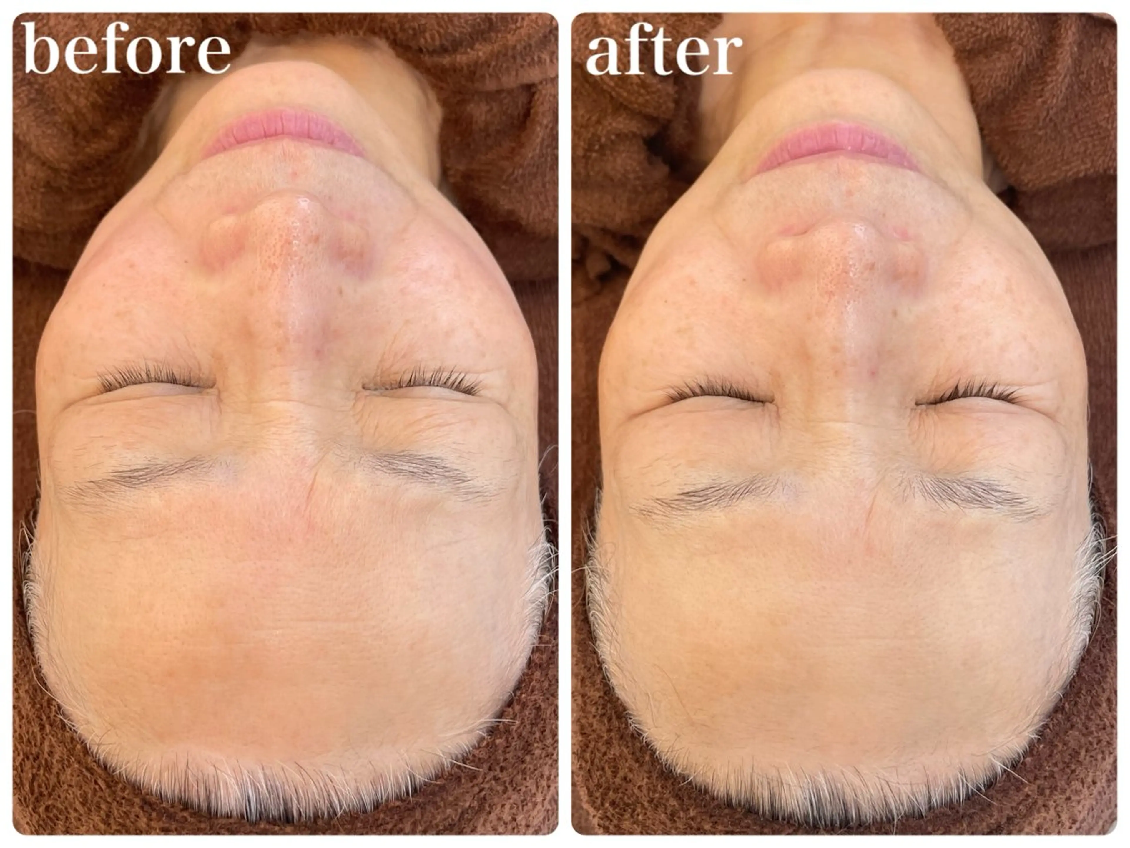 エステ リラク パーソナルスキンケア 🦋APRI🅿️有のエステ・リラクイメージ